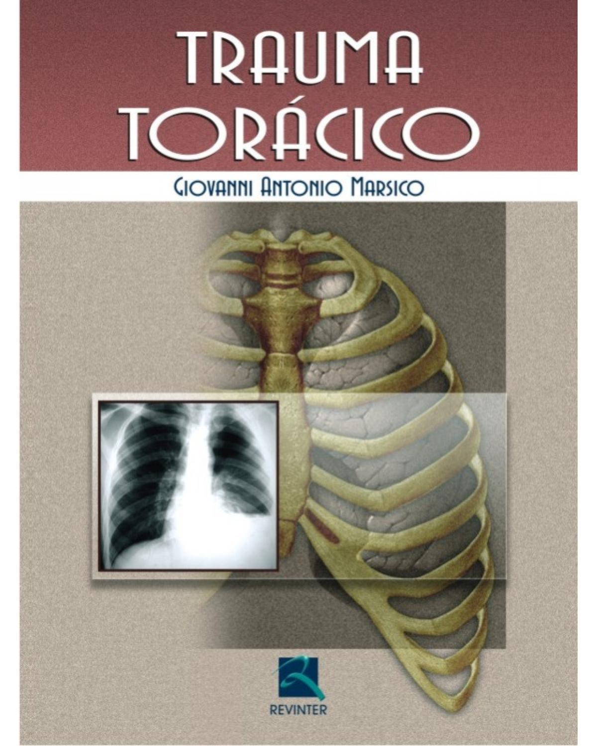 Trauma torácico - 1ª Edição | 2006