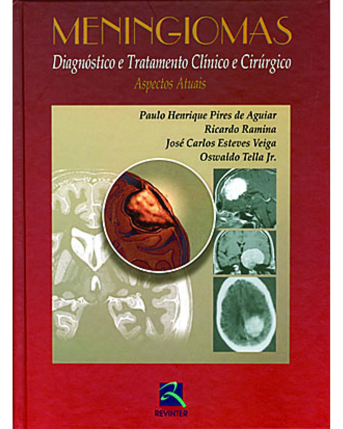 Meningiomas - diagnóstico e tratamento clínico e cirúrgico - Aspectos atuais - 1ª Edição | 2006