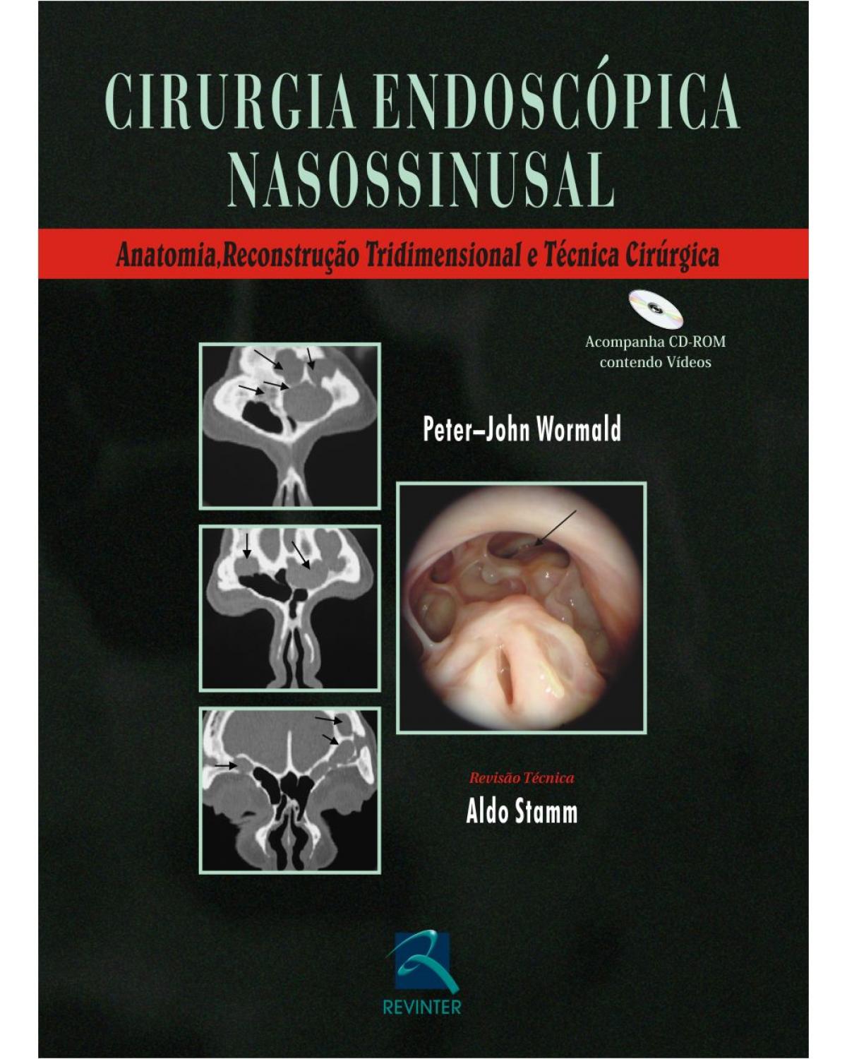 Cirurgia endoscópica nasossinusal - 1ª Edição | 2007