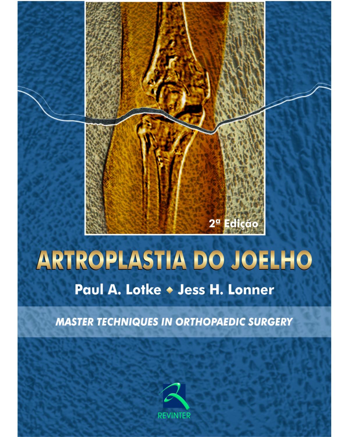 Artroplastia do joelho - 2ª Edição | 2007