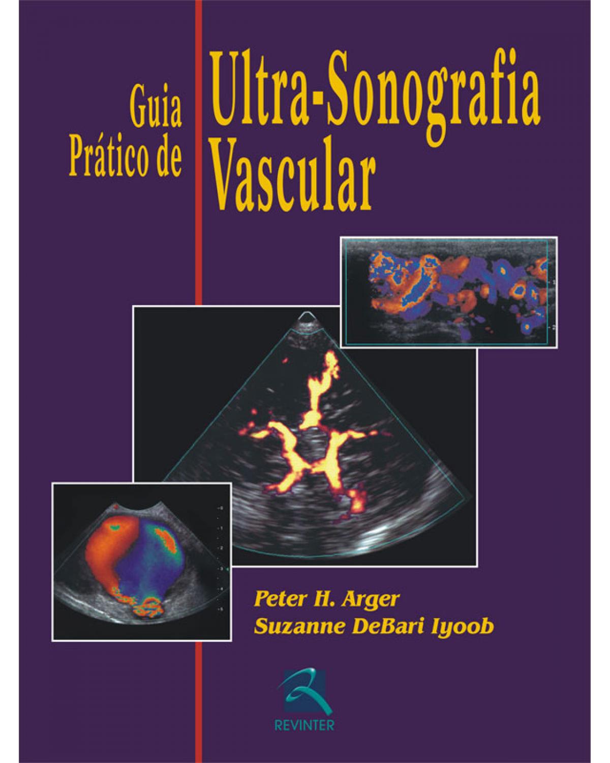 Guia prático de ultra-sonografia vascular - 1ª Edição | 2007