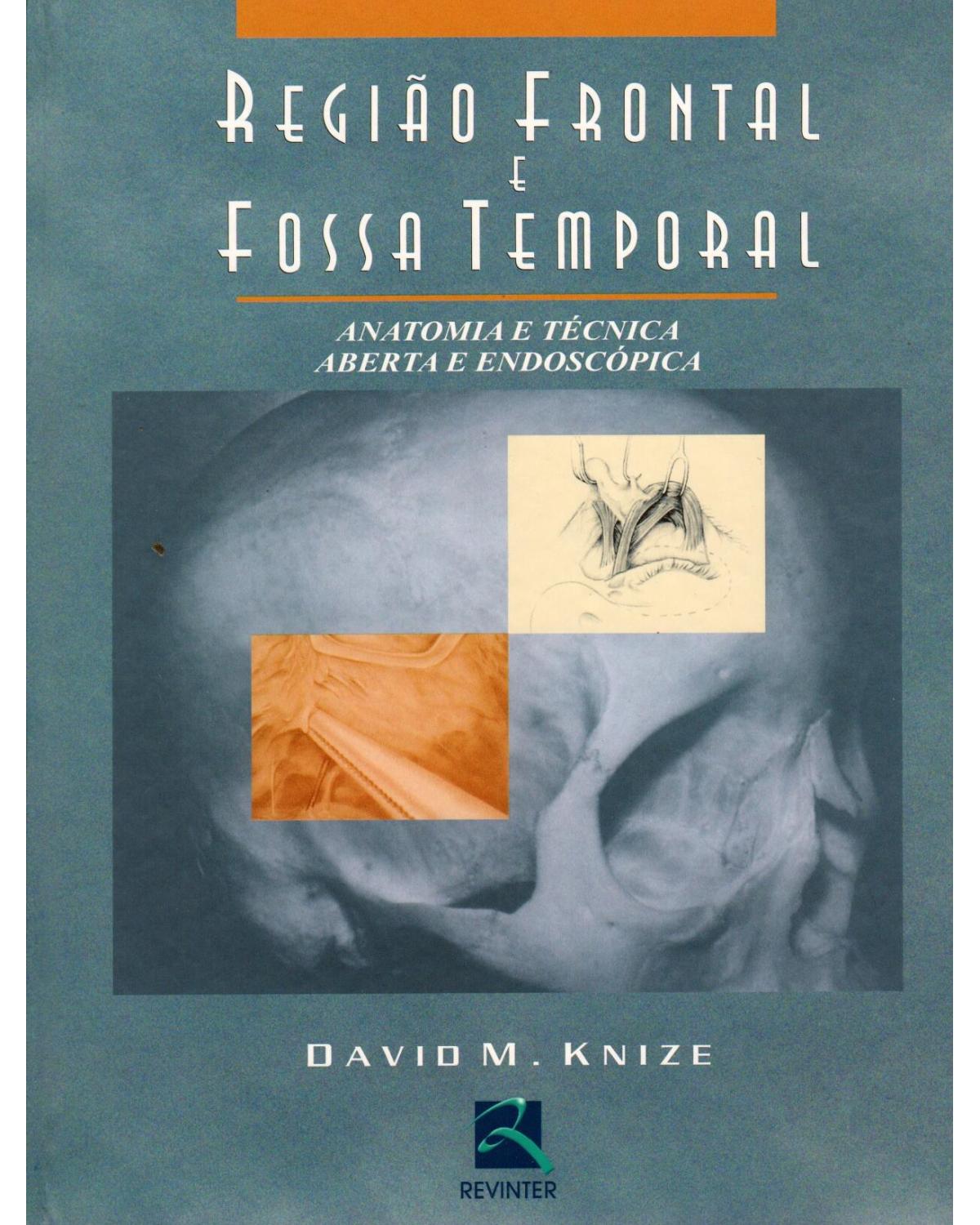 Região frontal e fossa temporal - anatomia e técnica aberta e endoscópica - 1ª Edição | 2007
