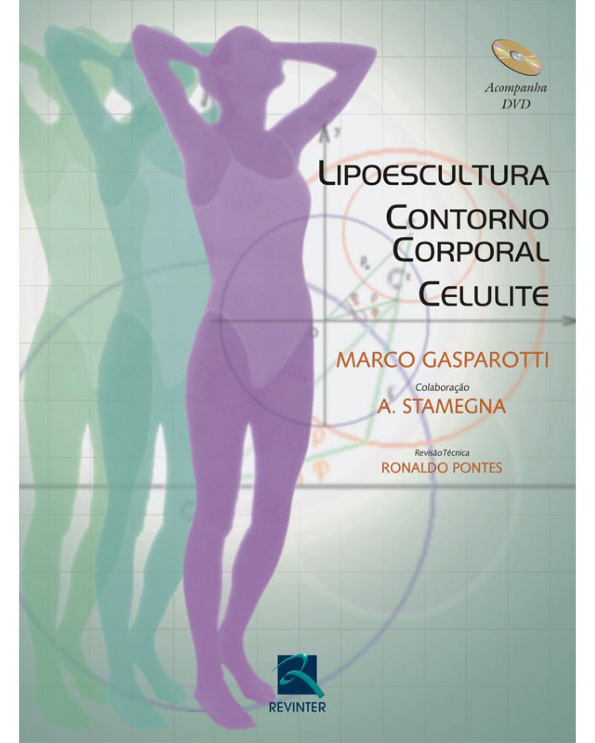 Lipoescultura, contorno corporal, celulite - 1ª Edição | 2008
