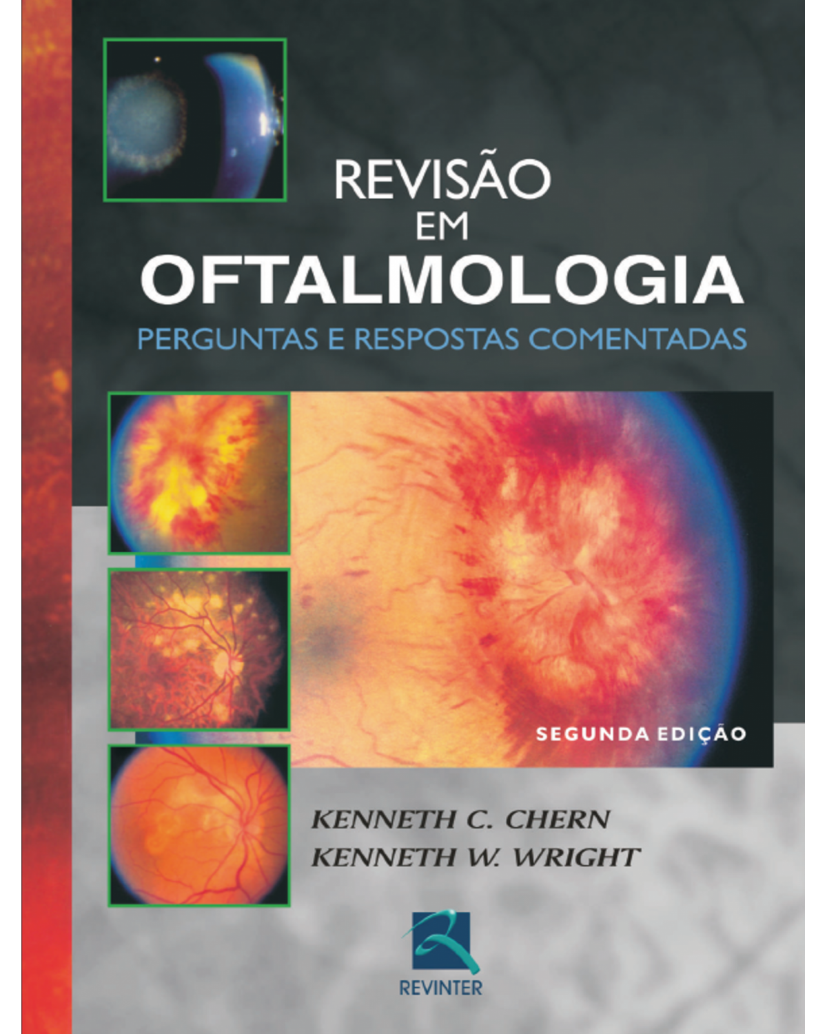 Revisão em oftalmologia - perguntas e respostas comentadas - 2ª Edição | 2008