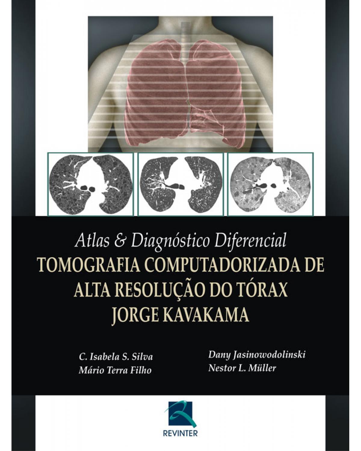 Atlas e diagnóstico diferencial - tomografia computadorizada de alta resolução do tórax - Jorge Kavakama - 1ª Edição | 2008