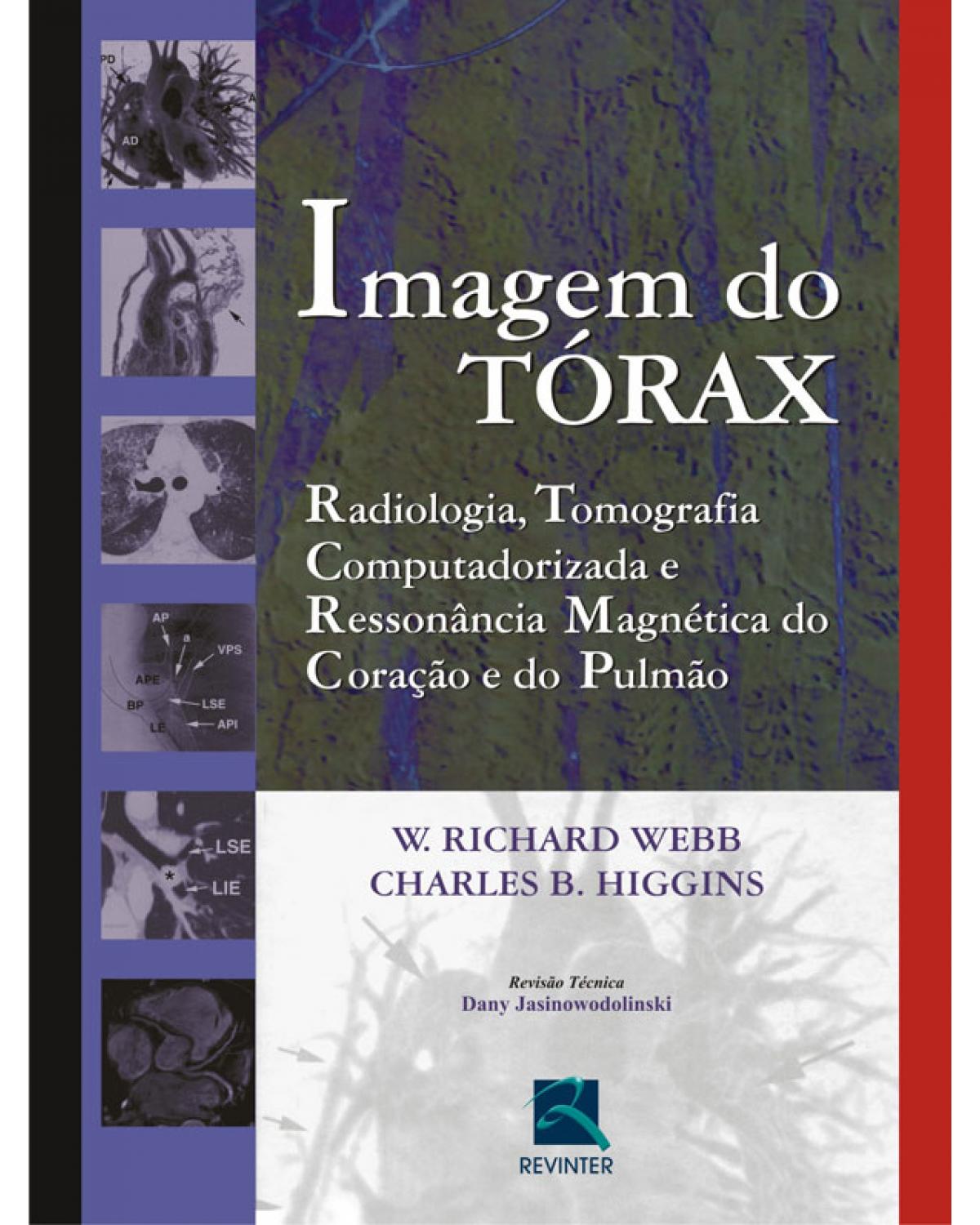 Imagem do tórax - radiologia, tomografia computadorizada e ressonância magnética do coração e do pulmão - 1ª Edição | 2008