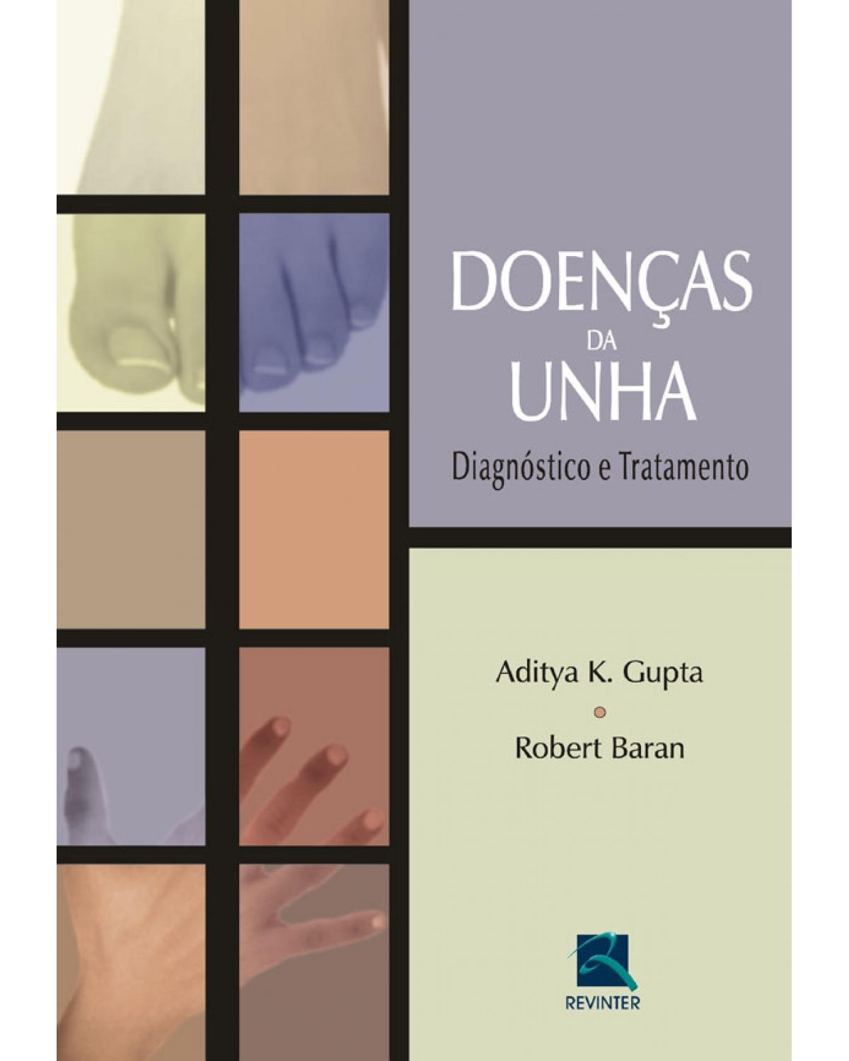 Doenças da unha - diagnóstico e tratamento - 1ª Edição | 2008