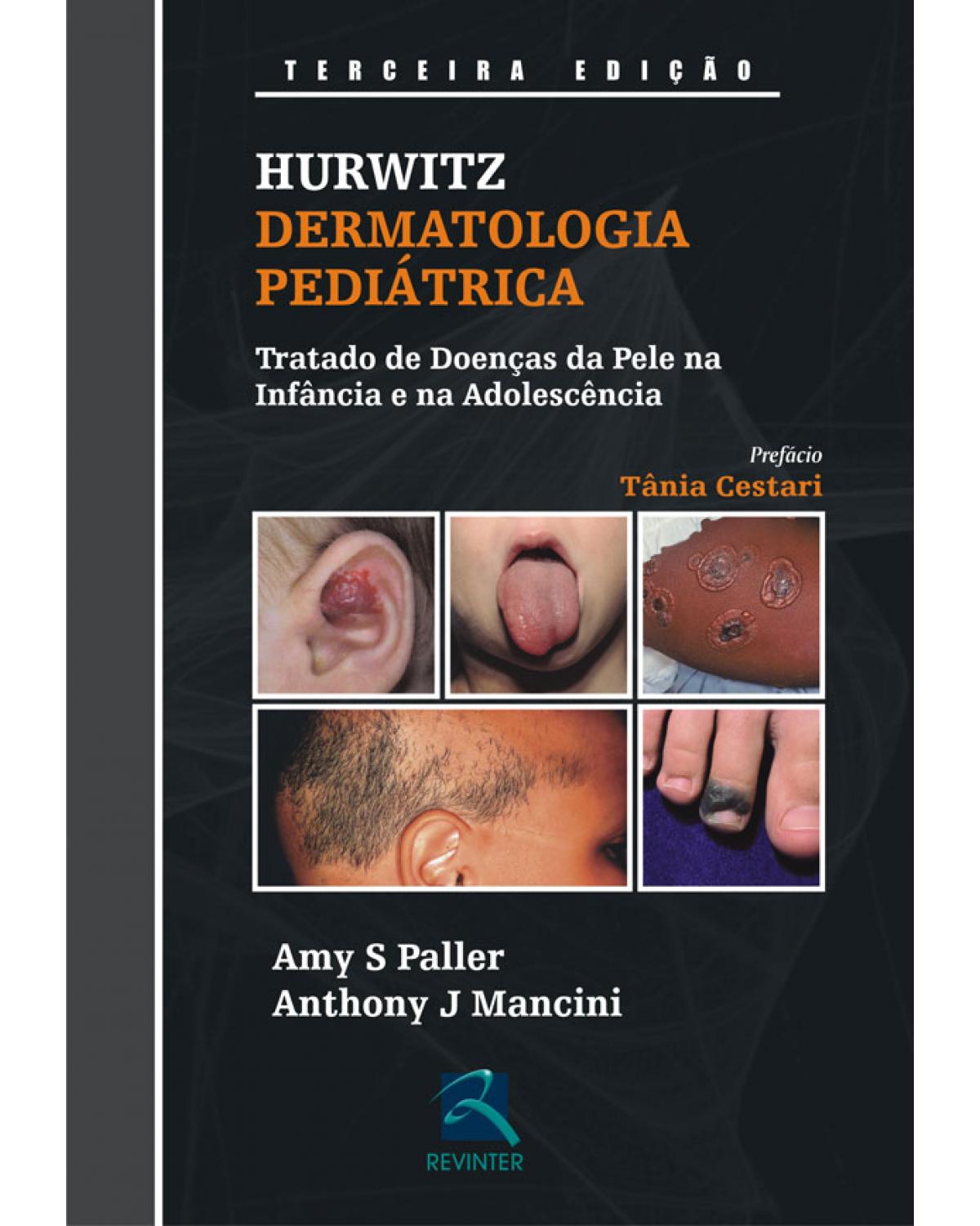 Hurwitz - Dermatologia pediátrica - tratado de doenças da pele na infância e na adolescência - 3ª Edição | 2009