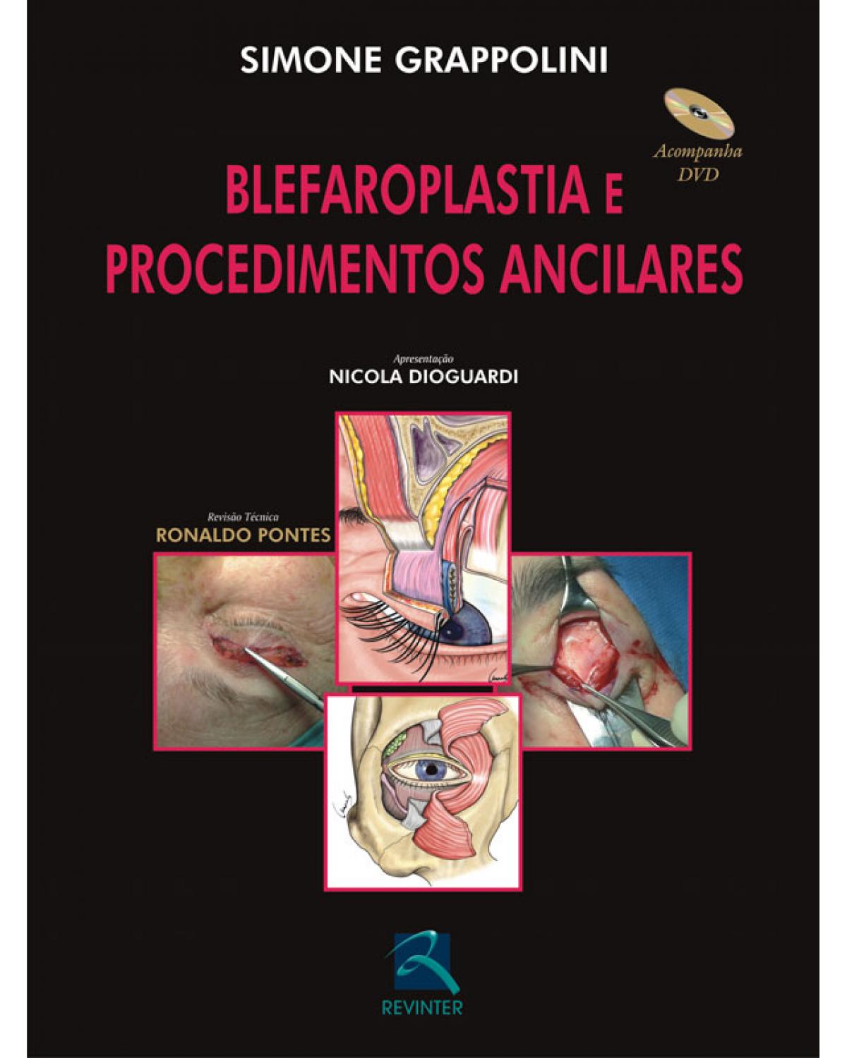 Blefaroplastia e procedimentos ancilares - 1ª Edição | 2010