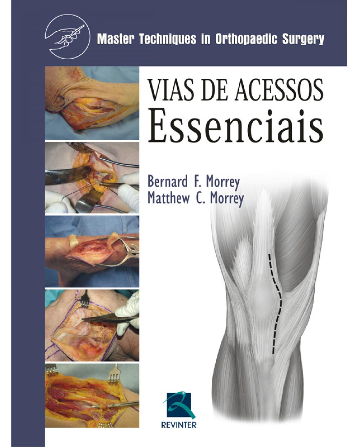 Vias de acessos essenciais - master techniques in orthopaedic surgery - 1ª Edição | 2010