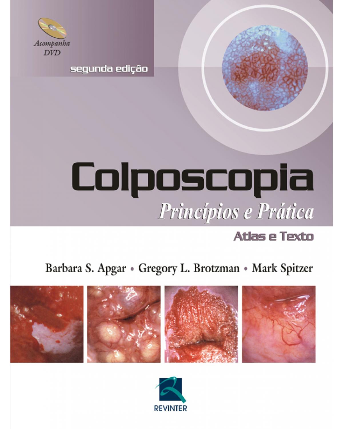 Colposcopia - princípios e prática - 1ª Edição | 2010