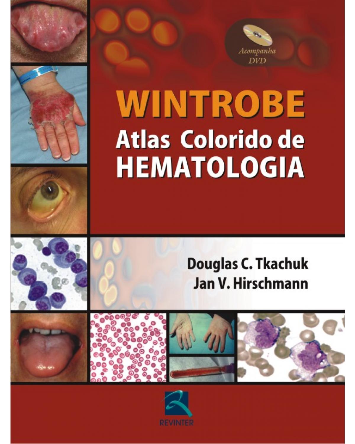 Wintrobe - Atlas colorido de hematologia - 1ª Edição | 2010