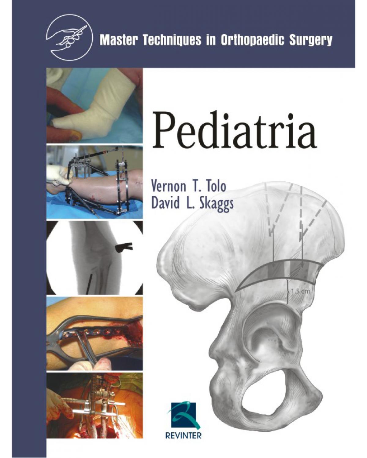 Pediatria - master techniques in orthopaedic surgery - 1ª Edição | 2010