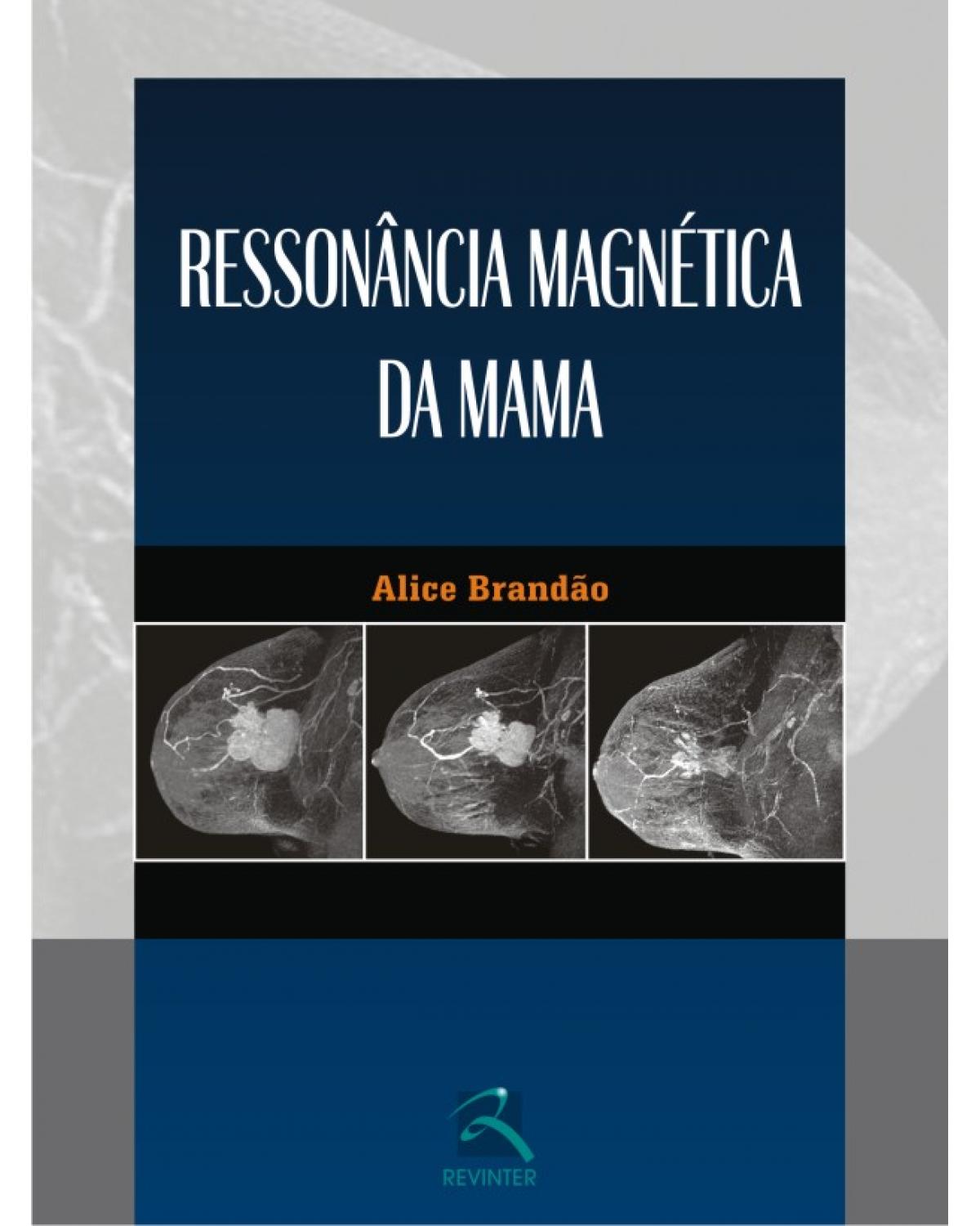Ressonância magnética da mama - 1ª Edição | 2010
