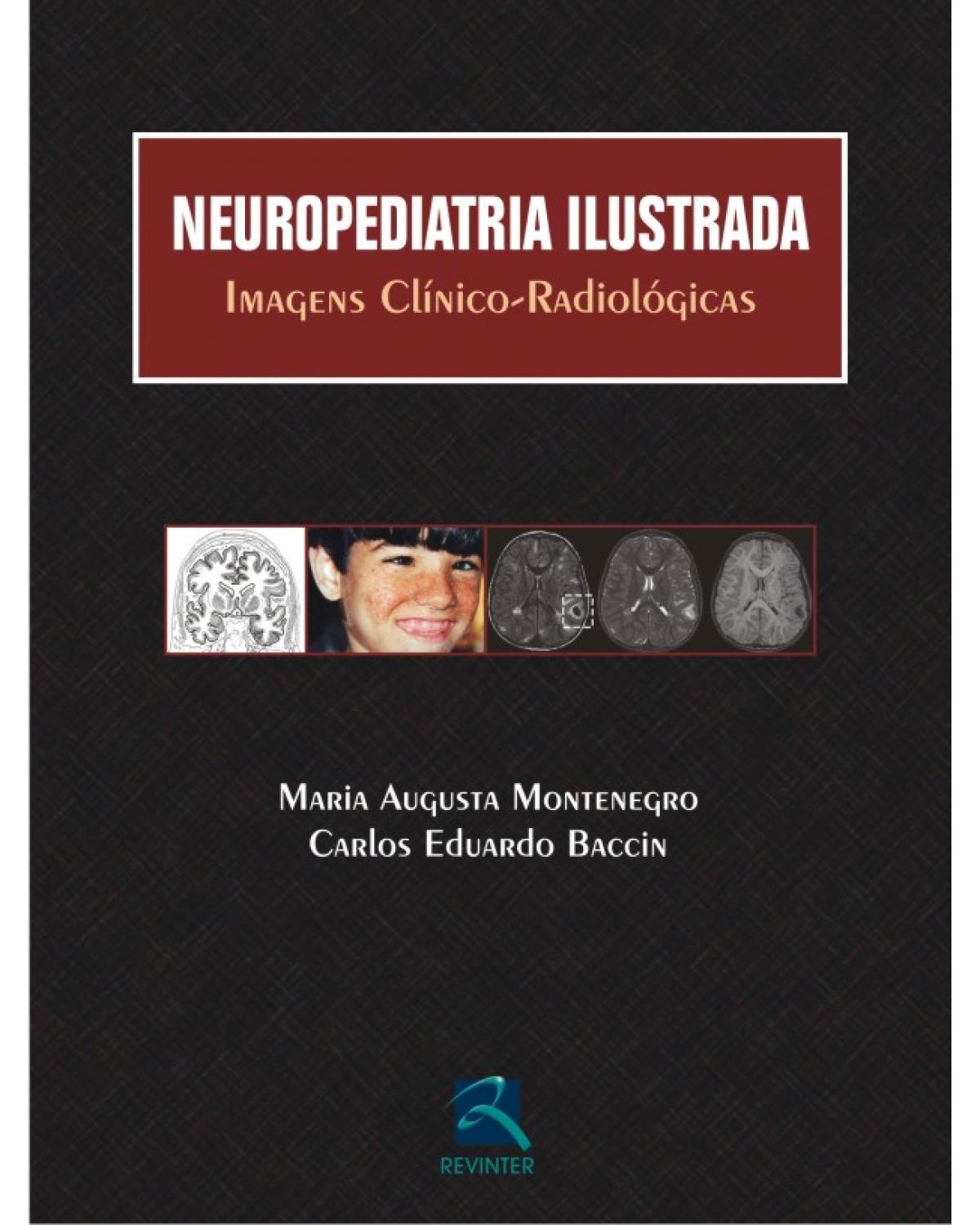 Neuropediatria ilustrada - imagens clínico-radiológicas - 1ª Edição | 2010