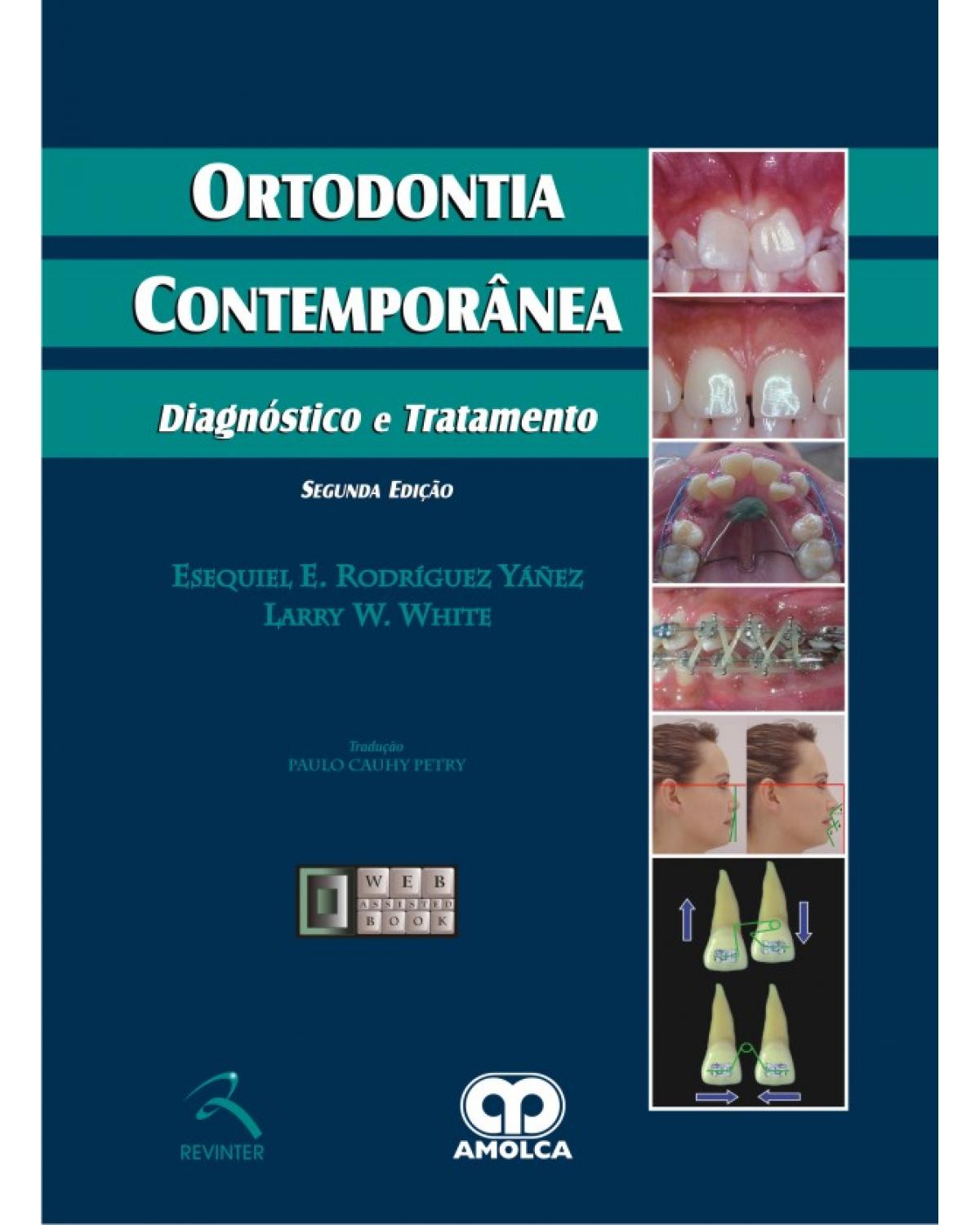 Ortodontia contemporânea - diagnóstico e tratamento - 2ª Edição | 2011