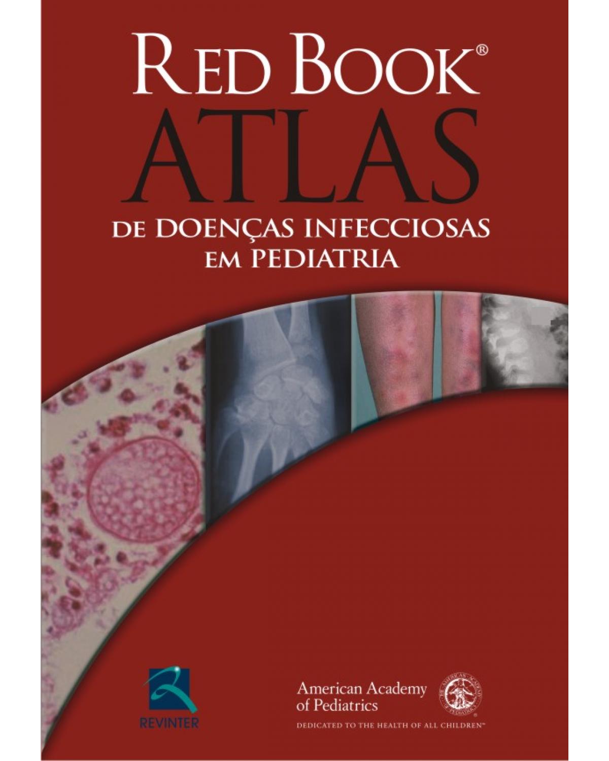 Red book - Atlas de doenças infecciosas em pediatria - casos clínicos - 1ª Edição | 2011