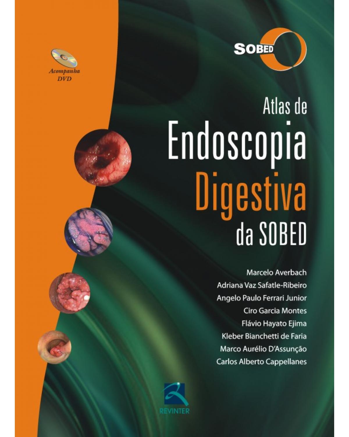 Atlas de endoscopia digestiva da SOBED - 1ª Edição | 2011