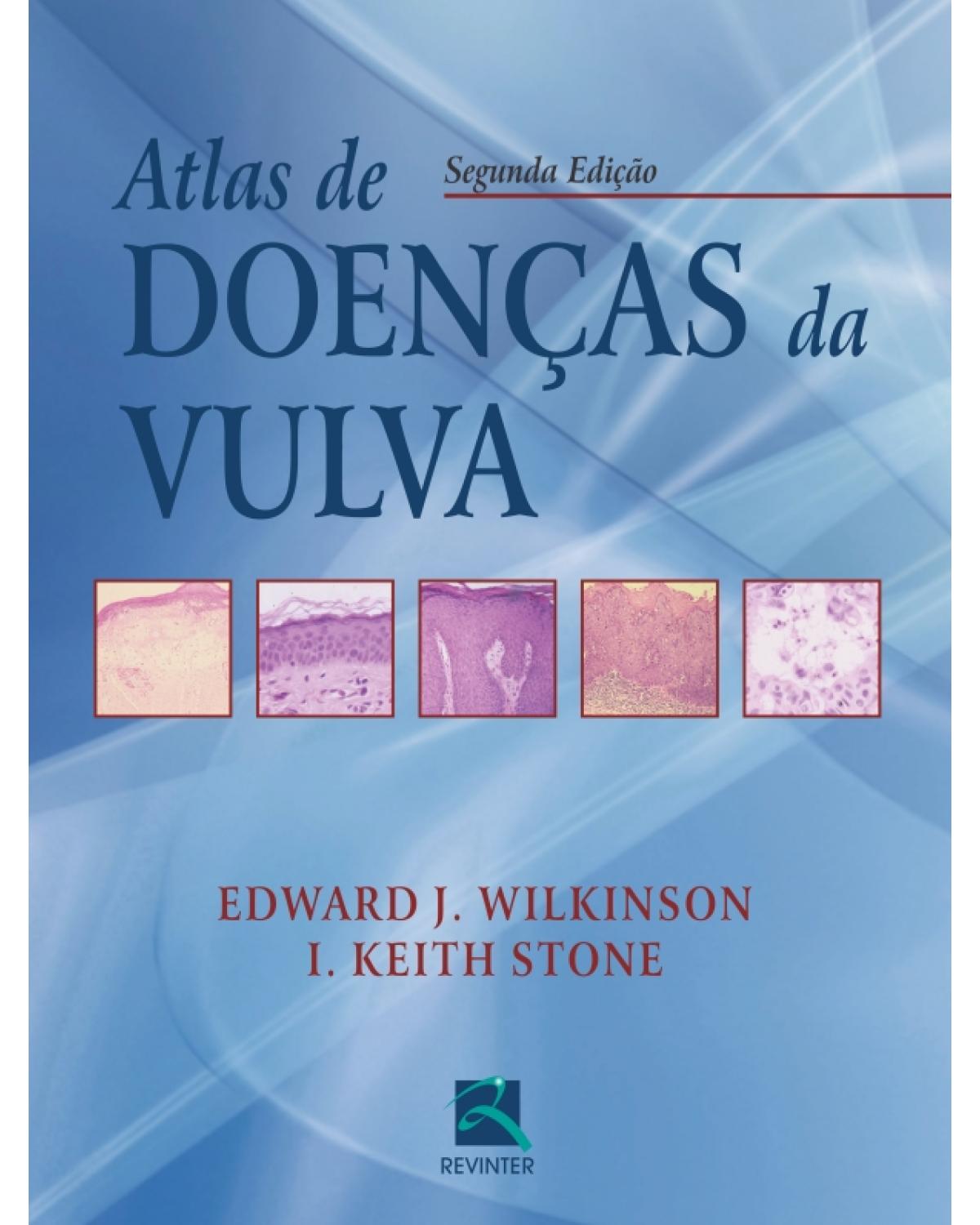 Atlas de doenças da vulva - 2ª Edição | 2011