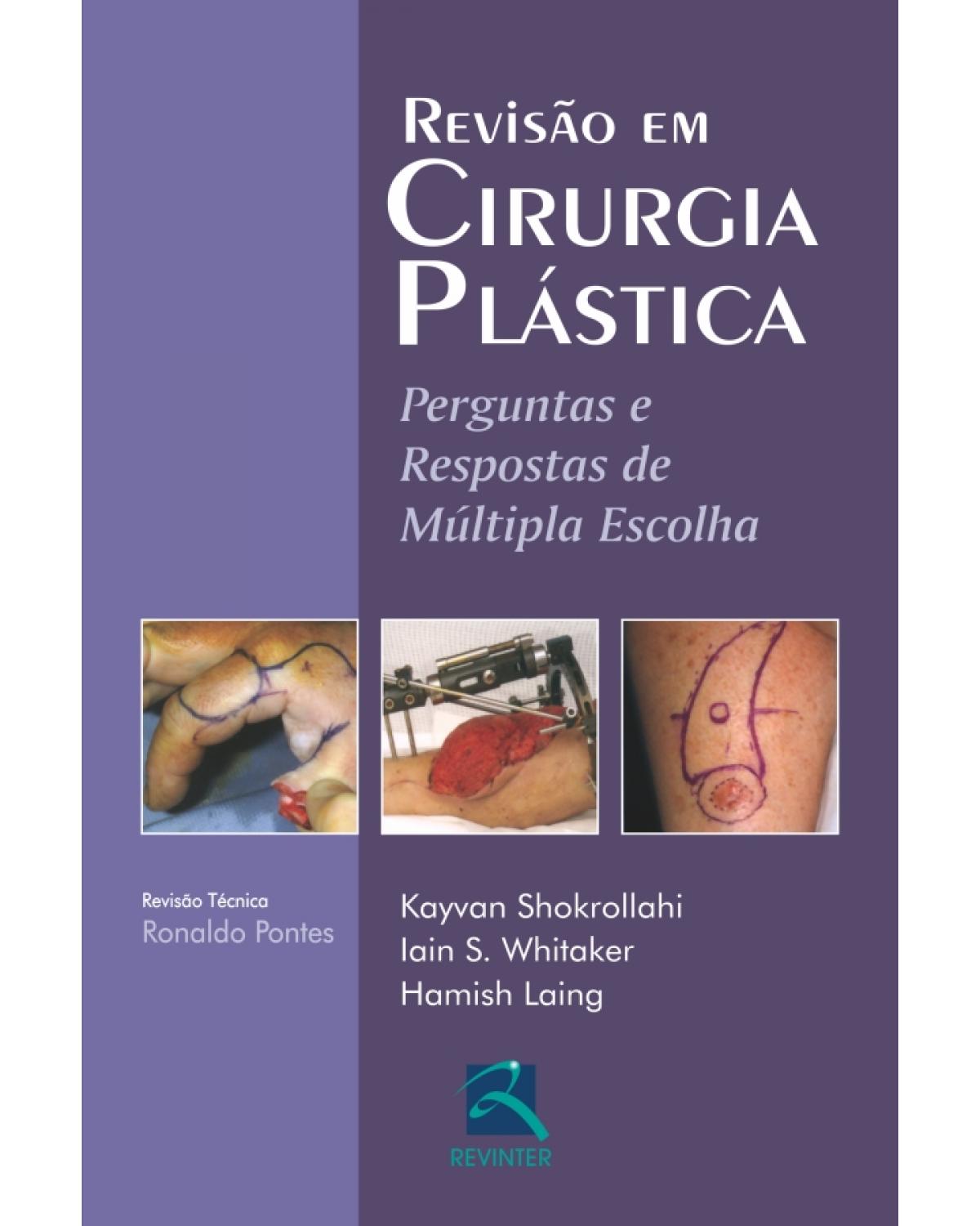 Revisão em cirurgia plástica - perguntas e respostas de múltipla escolha - 1ª Edição | 2011