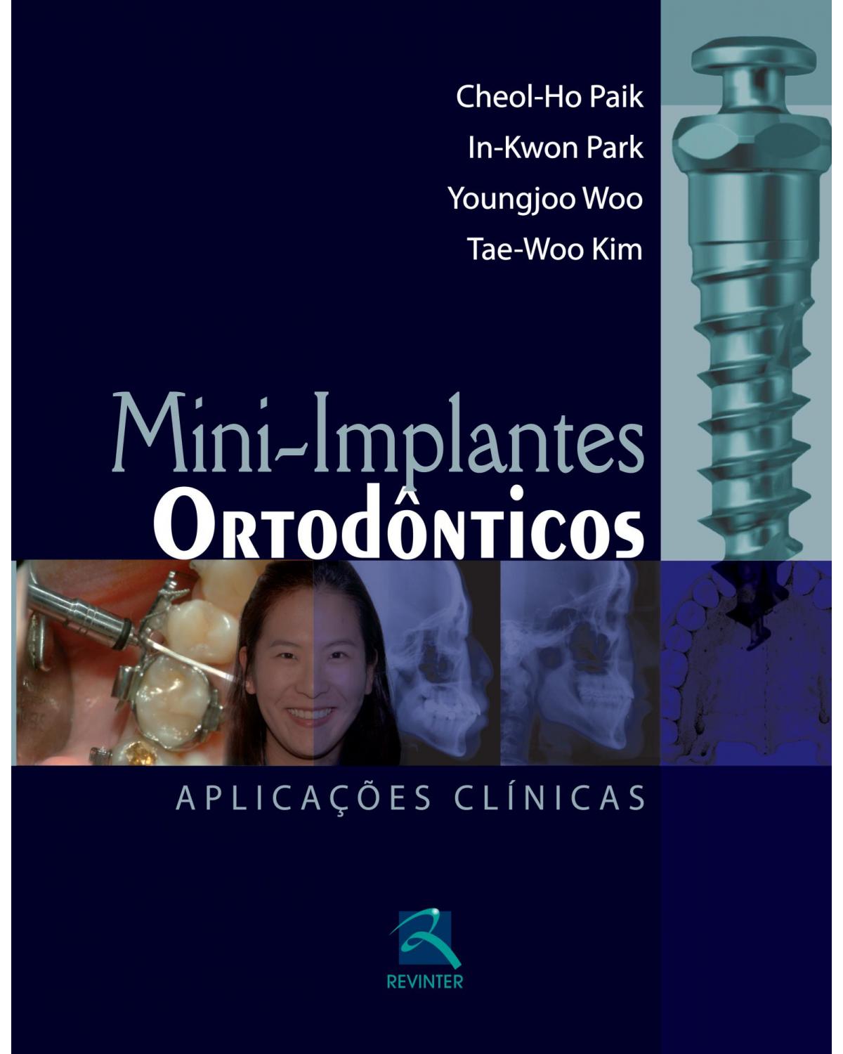 Mini-implantes ortodônticos - aplicações clínicas - 1ª Edição | 2012