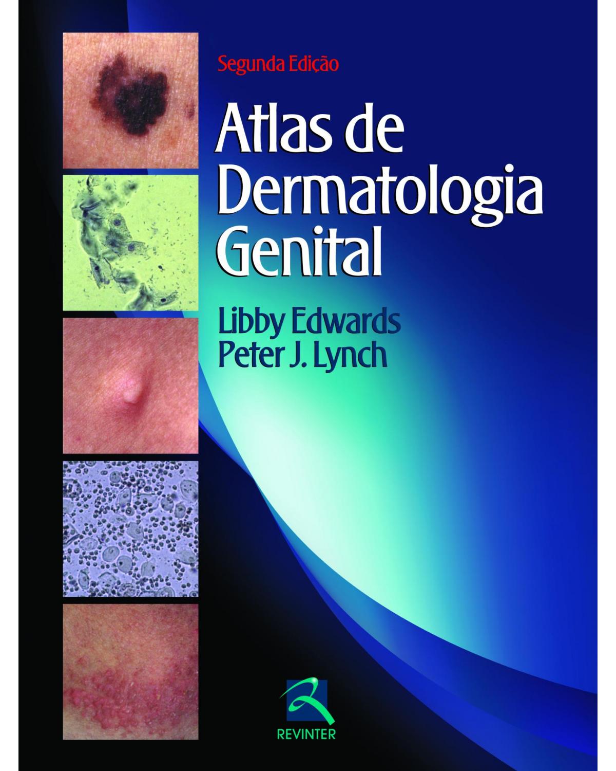 Atlas de dermatologia genital - 2ª Edição | 2012