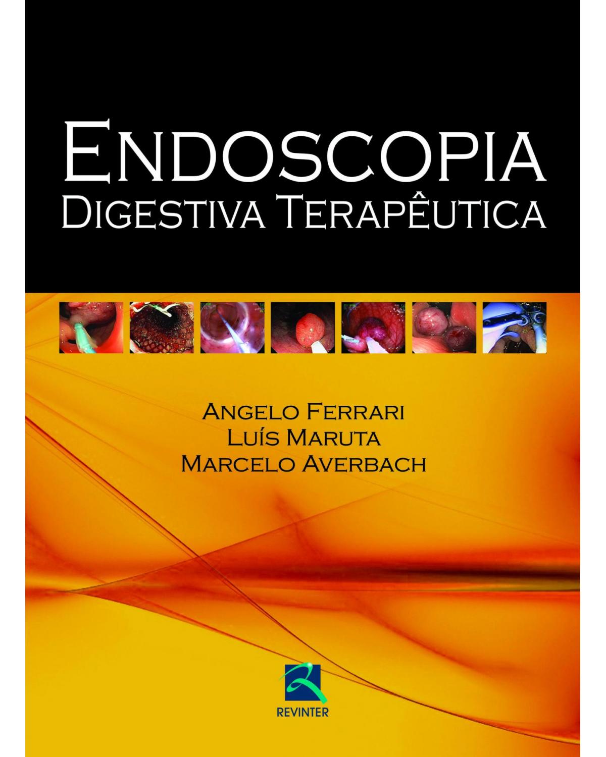 Endoscopia digestiva terapêutica - 1ª Edição | 2012