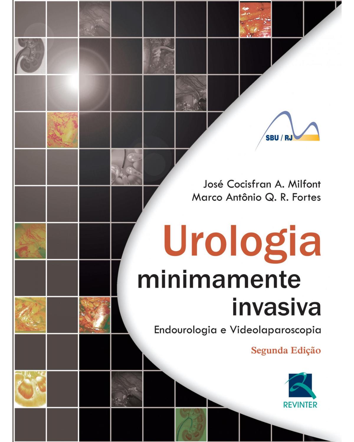 Urologia minimamente invasiva - endourologia e videolaparoscopia - 2ª Edição | 2012