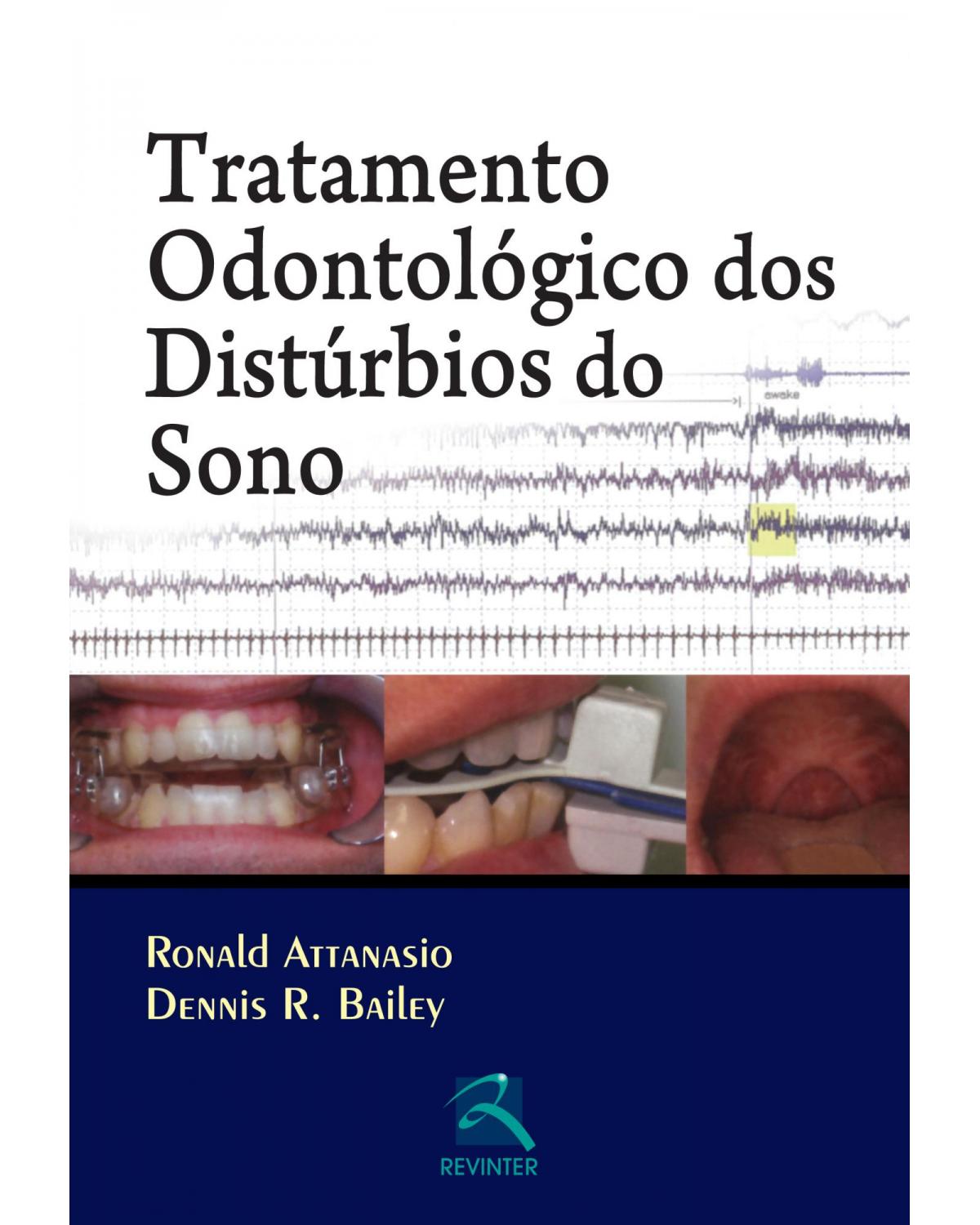 Tratamento odontológico dos distúrbios do sono - 1ª Edição | 2012