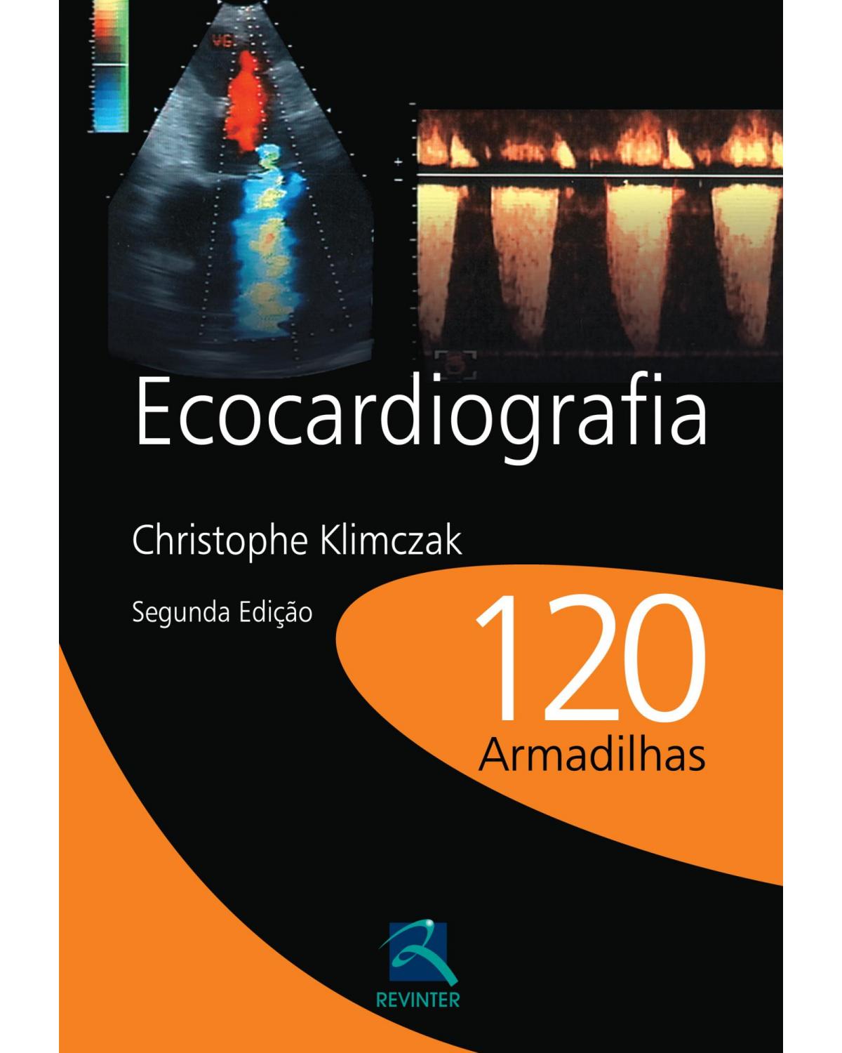 Ecocardiografia - 120 armadilhas - 2ª Edição | 2012