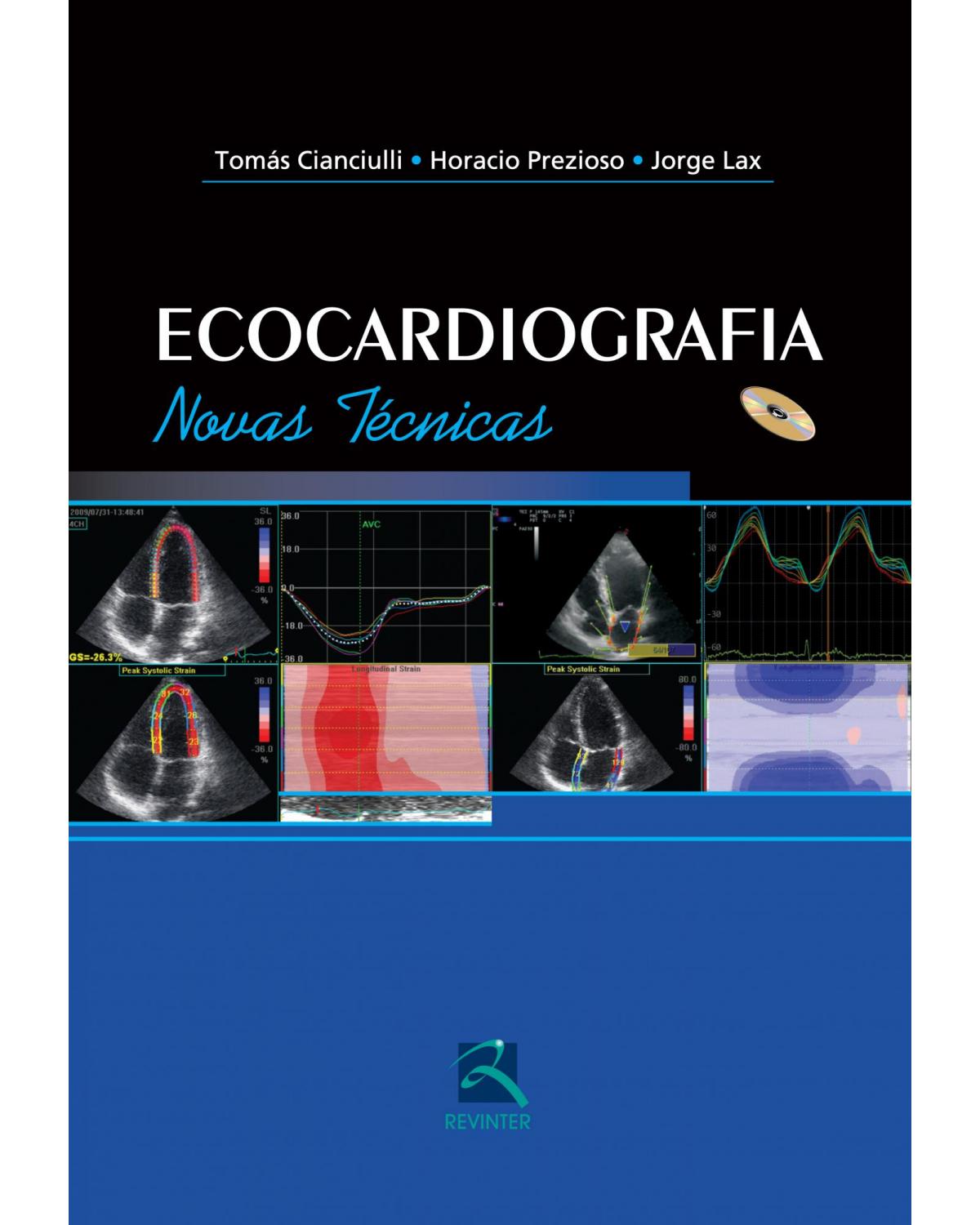 Ecocardiografia - novas técnicas - 1ª Edição | 2012