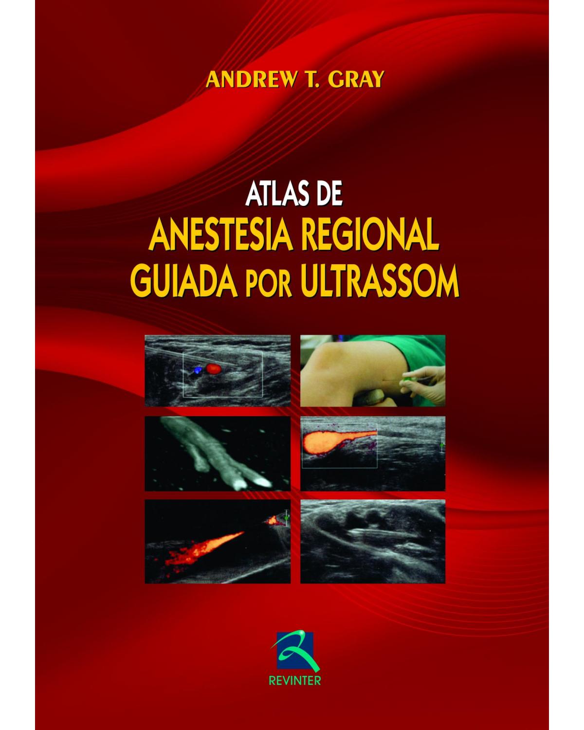 Atlas de anestesia regional guiada por ultrassom - 1ª Edição | 2012