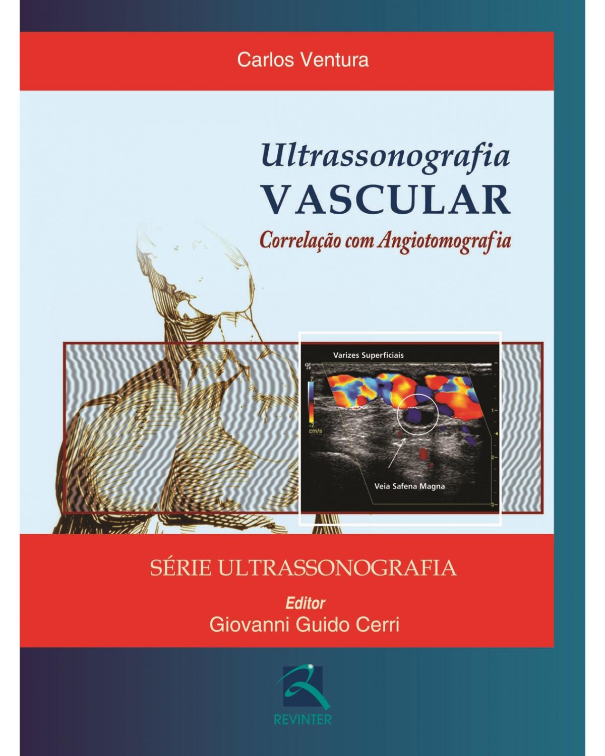 Ultrassonografia vascular - correlação com angiotomografia - 1ª Edição | 2012