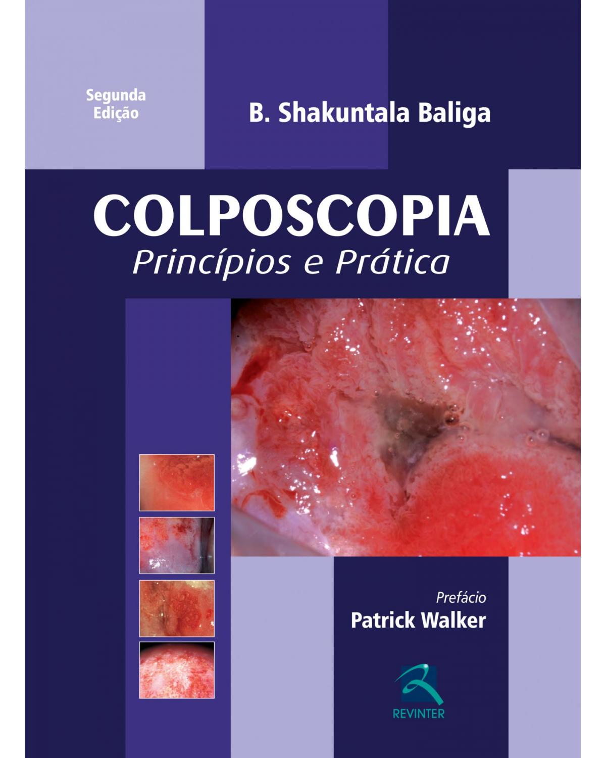 Colposcopia - princípios e prática - 2ª Edição | 2013