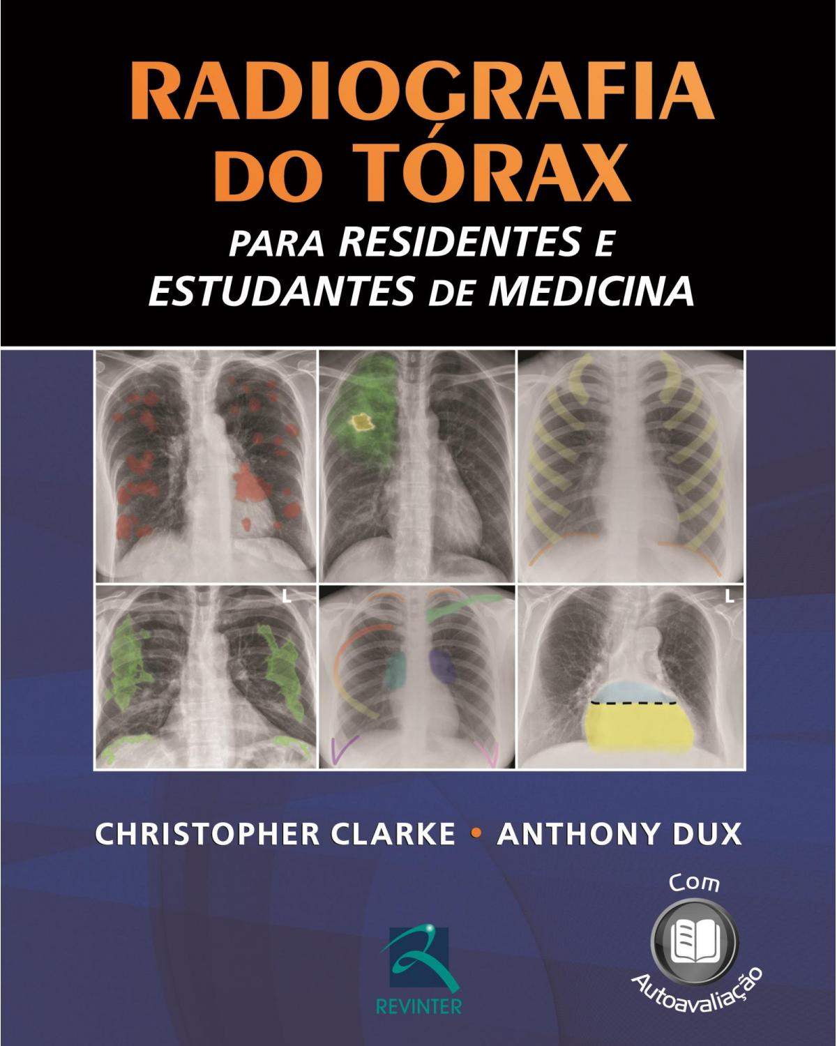 Radiografia do tórax para residentes e estudantes de medicina - 1ª Edição | 2012