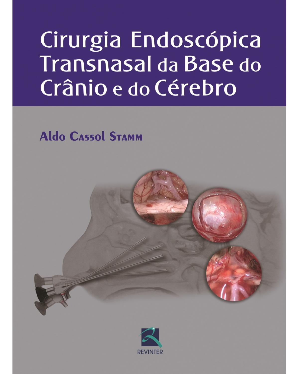 Cirurgia endoscópica transnasal da base do crânio e do cérebro - 1ª Edição | 2013