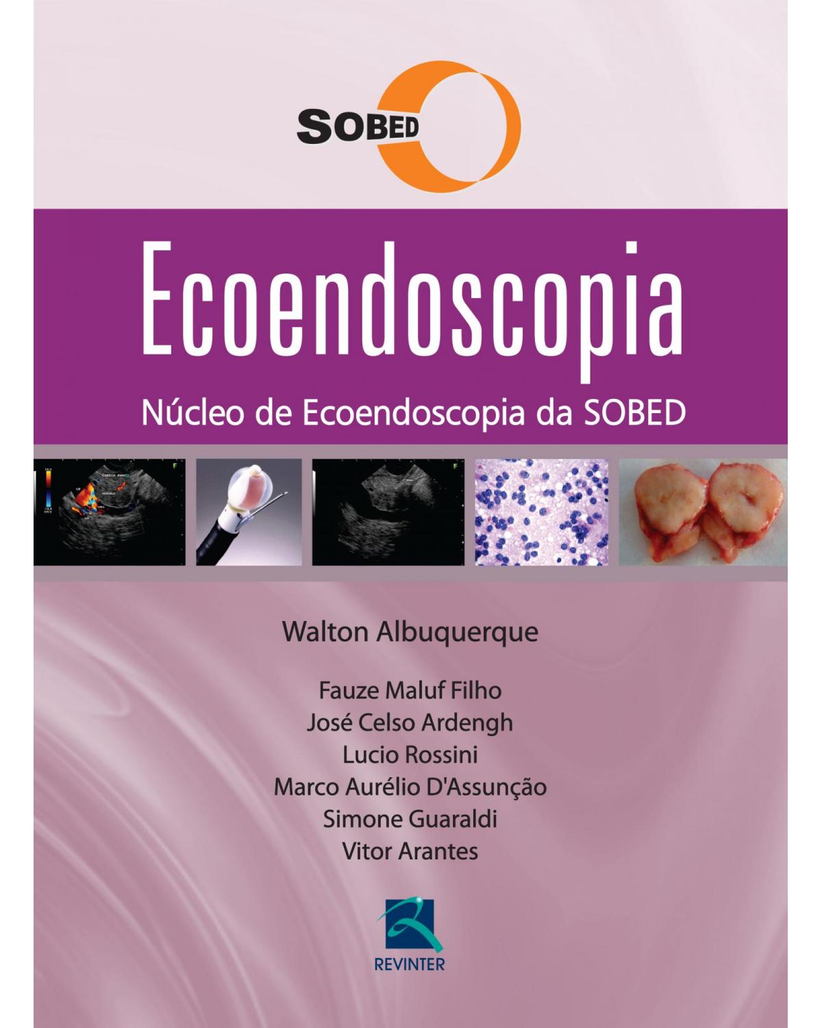 Ecoendoscopia - 1ª Edição | 2012