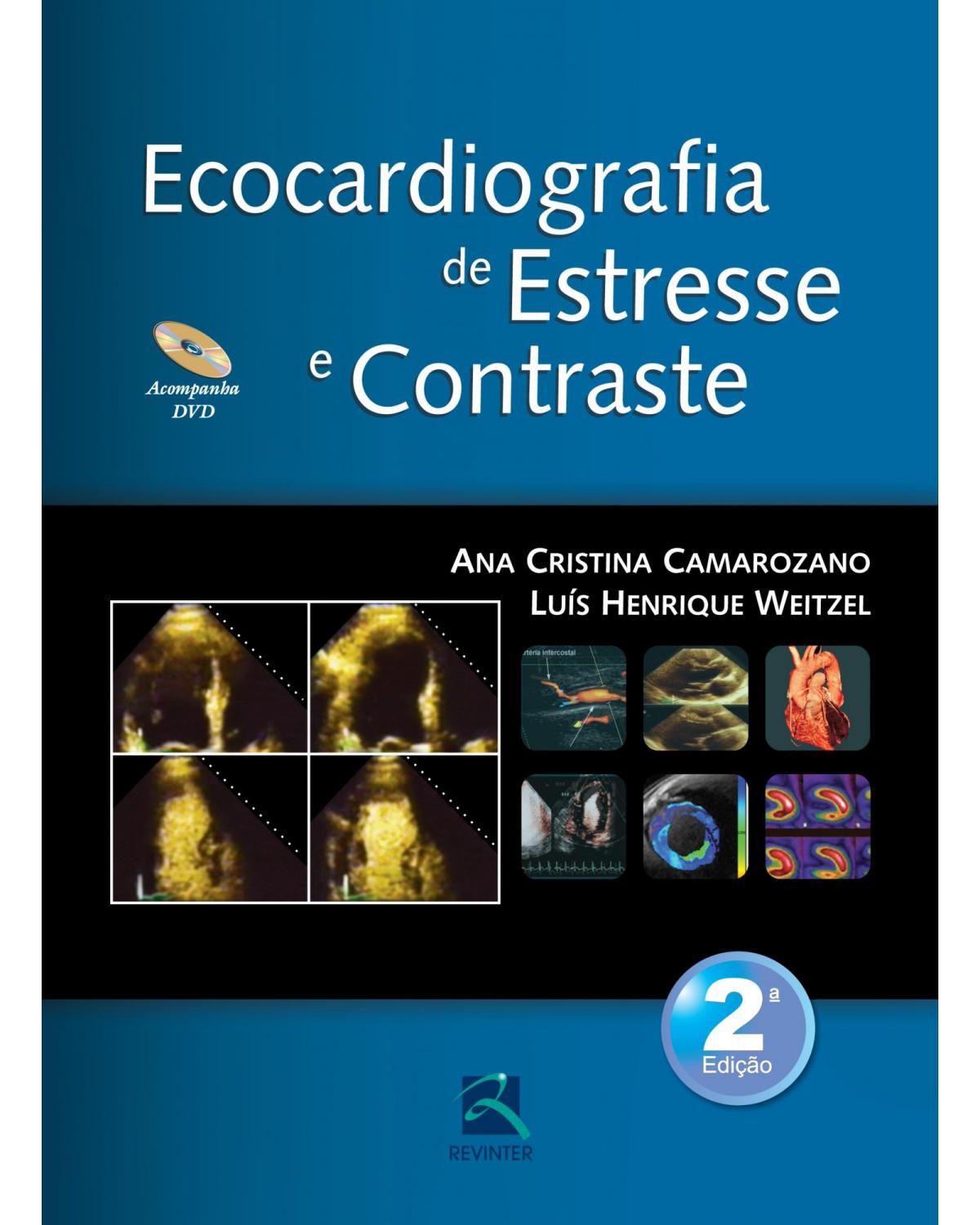 Ecocardiografia de estresse e contraste - 2ª Edição | 2013