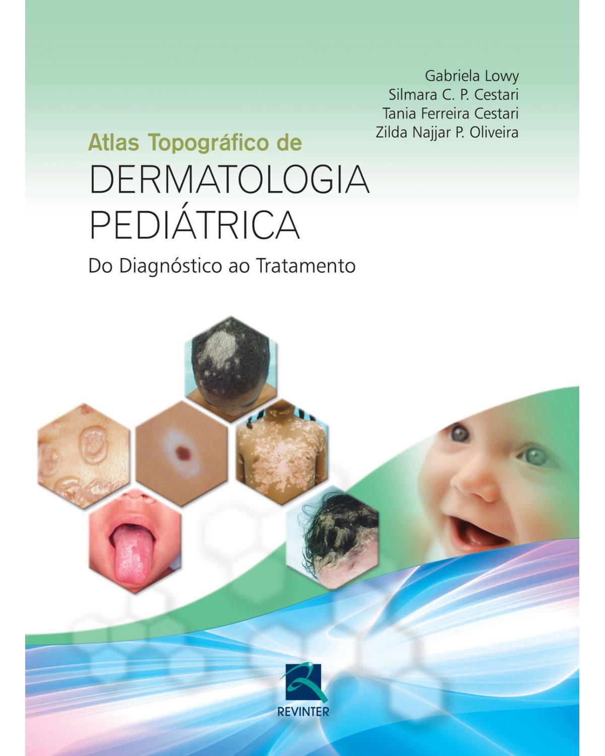 Atlas topográfico de dermatologia pediátrica: Do diagnóstico ao tratamento - 1ª Edição