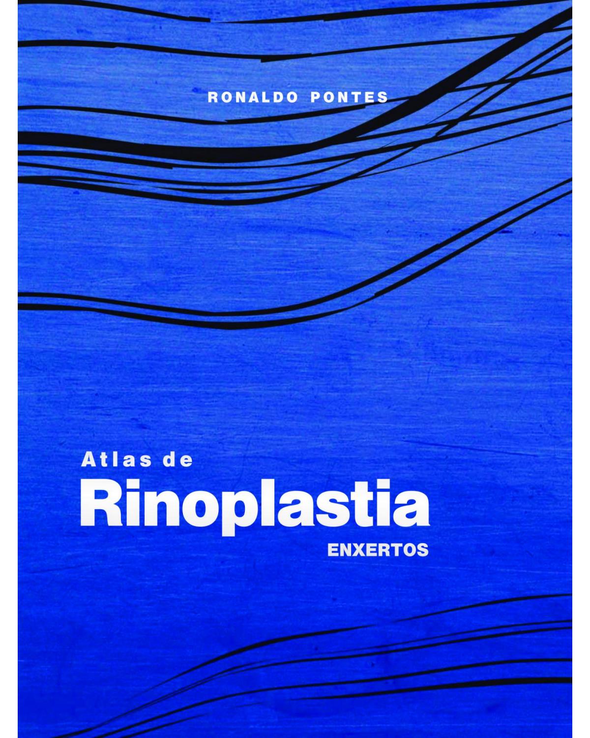 Atlas de rinoplastia: enxertos - 1ª Edição | 2013