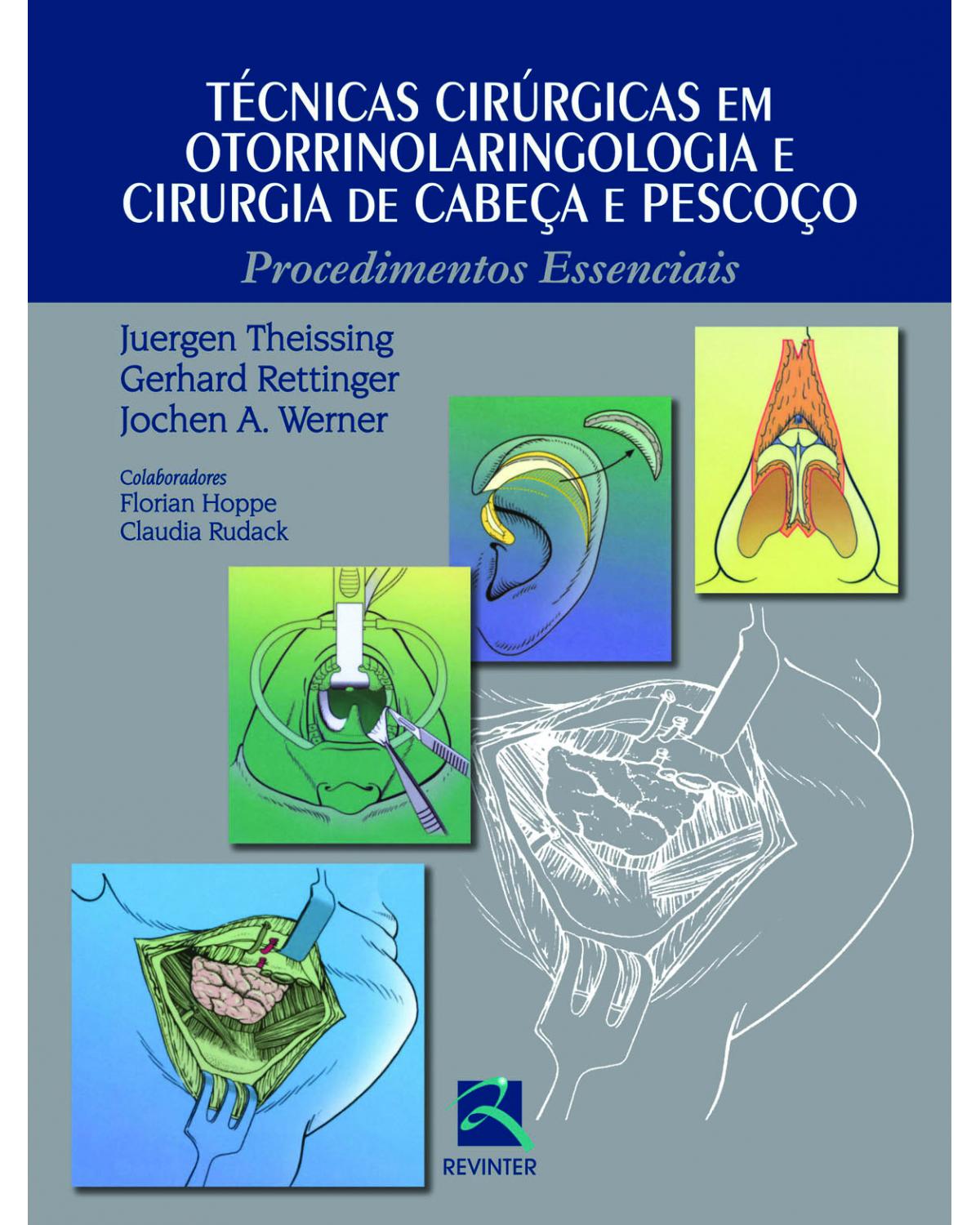 Técnicas cirúrgicas em otorrinolaringologia e cirurgia de cabeça e pescoço - procedimentos essenciais - 1ª Edição | 2013