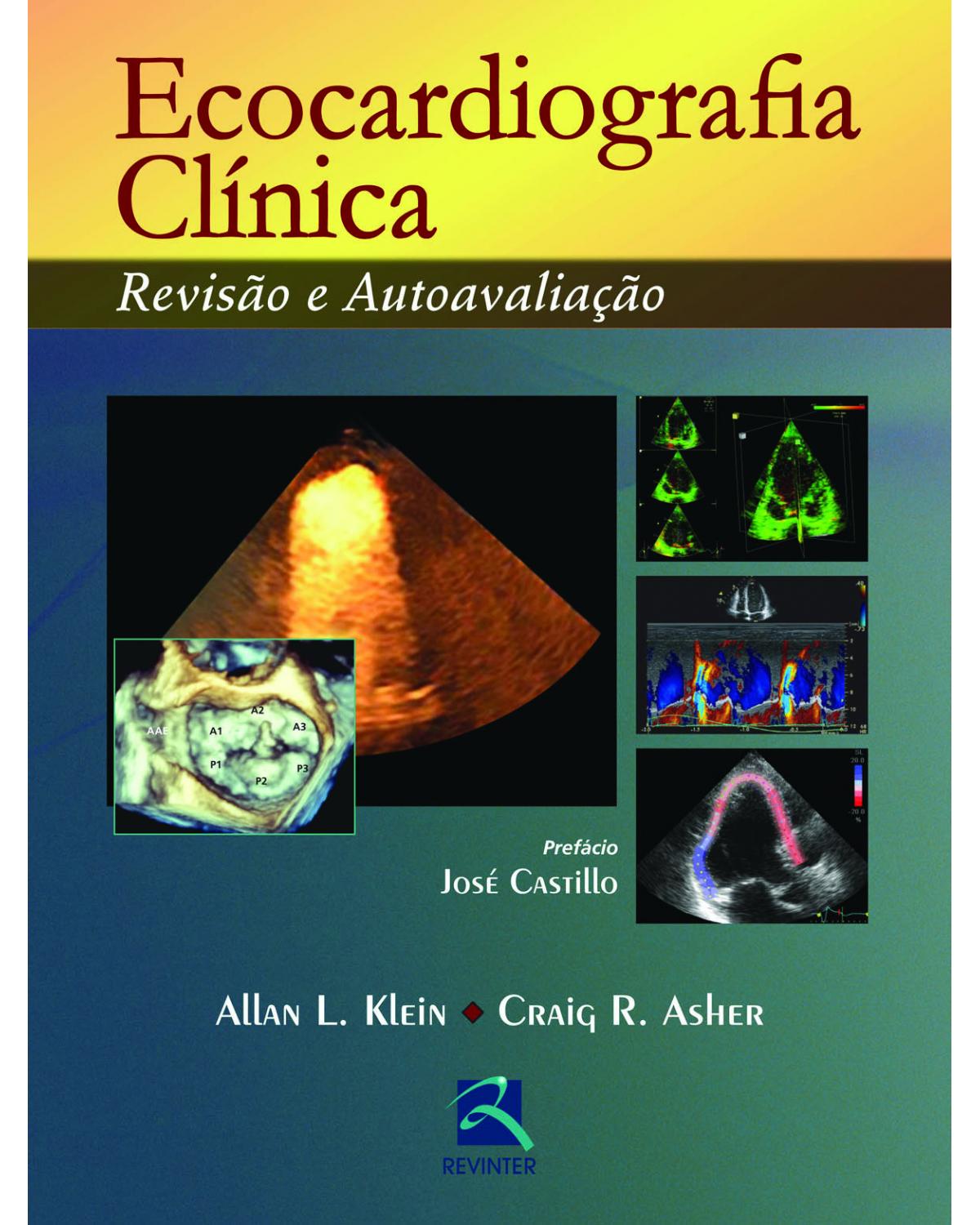 Ecocardiografia clínica - revisão e autoavaliação - 1ª Edição | 2013