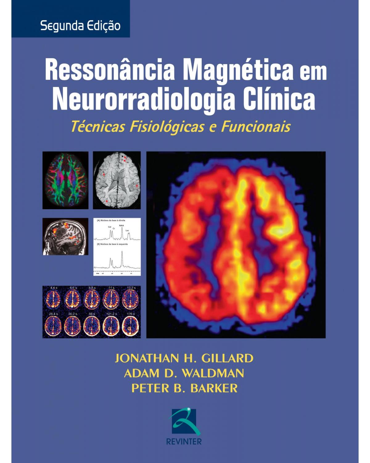 Ressonância magnética em neurorradiologia clínica - técnicas fisiológicas e funcionais - 2ª Edição | 2014