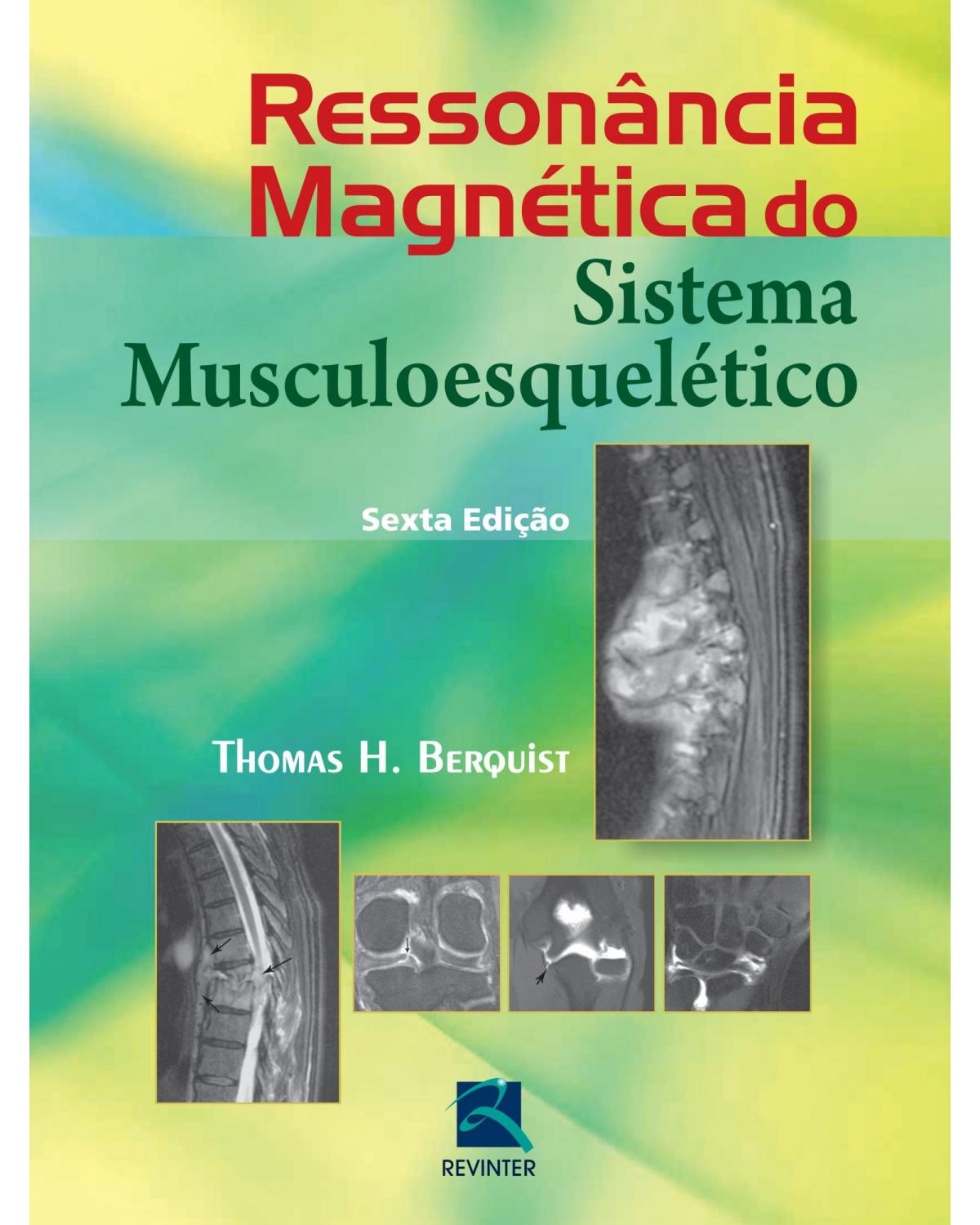 Ressonância magnética do sistema musculoesquelético - 6ª Edição | 2014