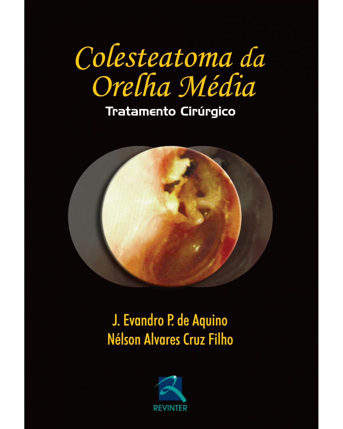 Colesteatoma da orelha média - tratatamento cirúrgico - 1ª Edição | 2014