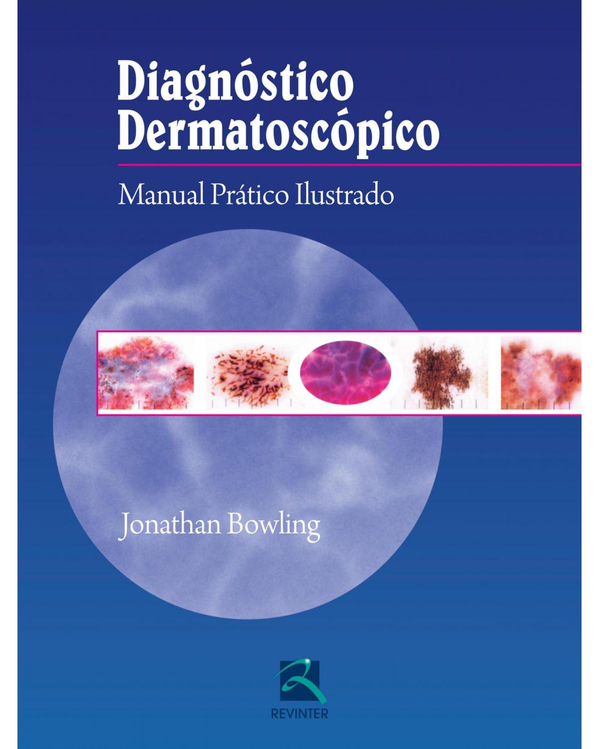 Diagnóstico dermatoscópico - manual prático ilustrado - 1ª Edição | 2014