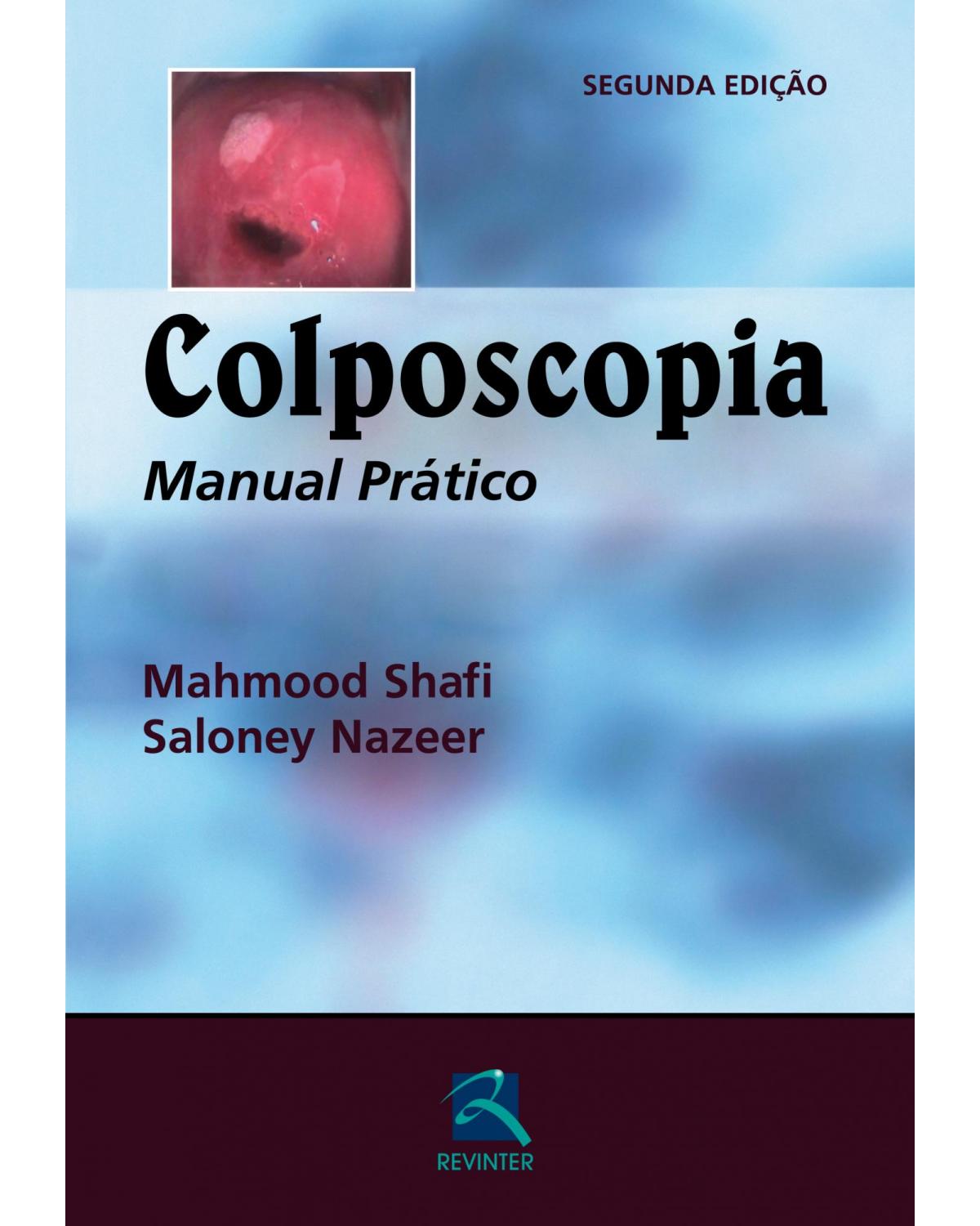 Colposcopia - manual prático - 2ª Edição | 2014
