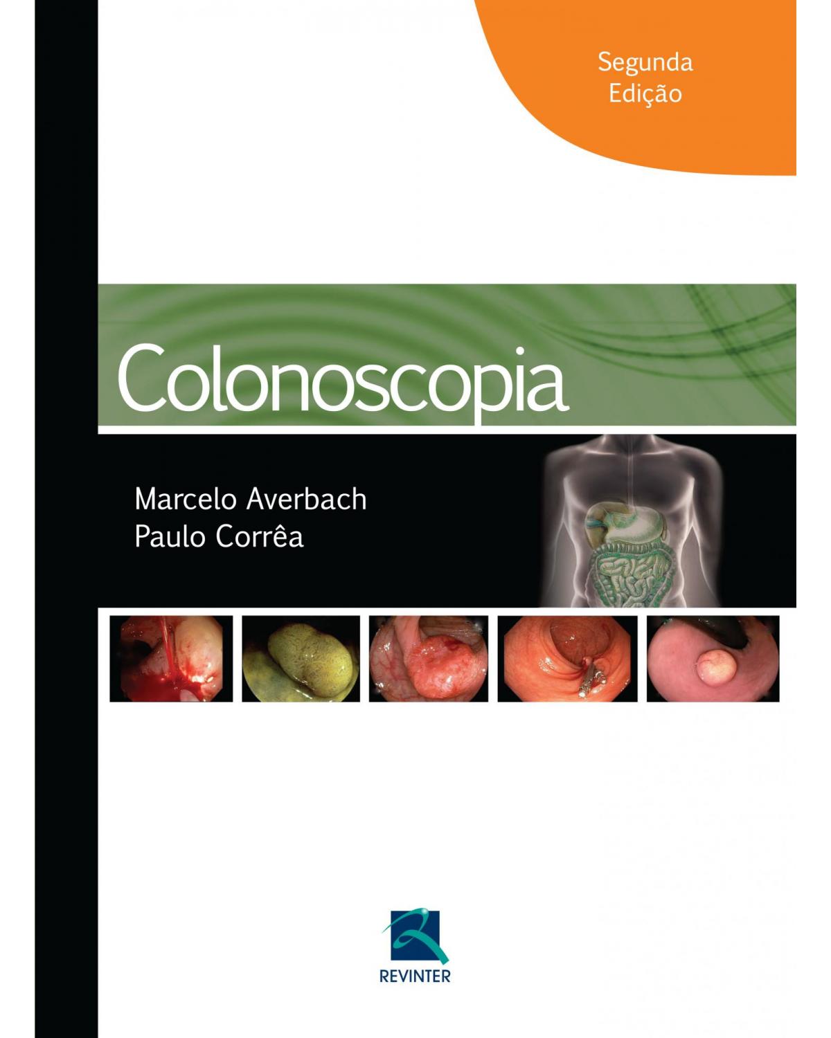 Colonoscopia - 2ª Edição | 2014