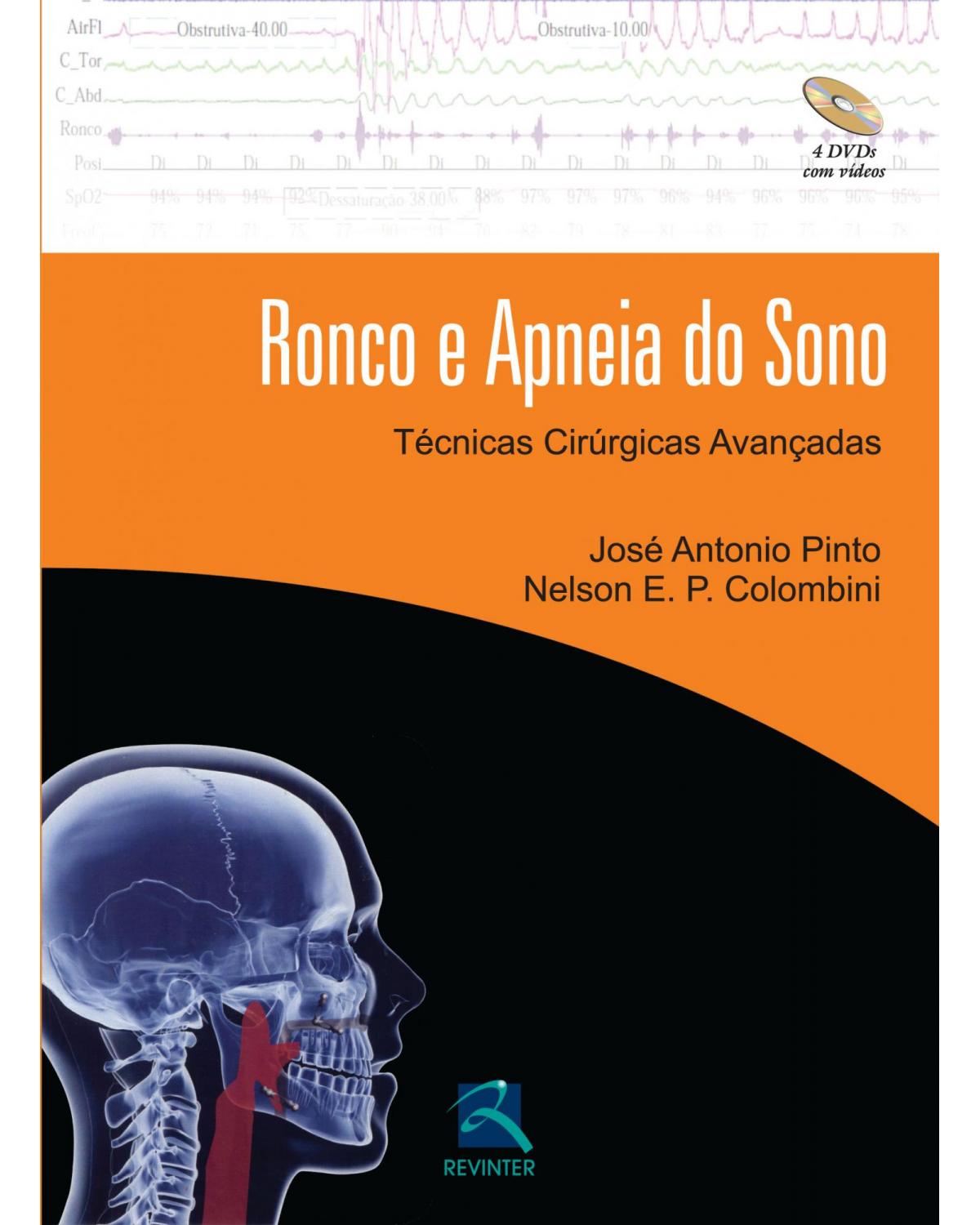 Ronco e apneia do sono - técnicas cirúrgicas avançadas - 1ª Edição | 2014