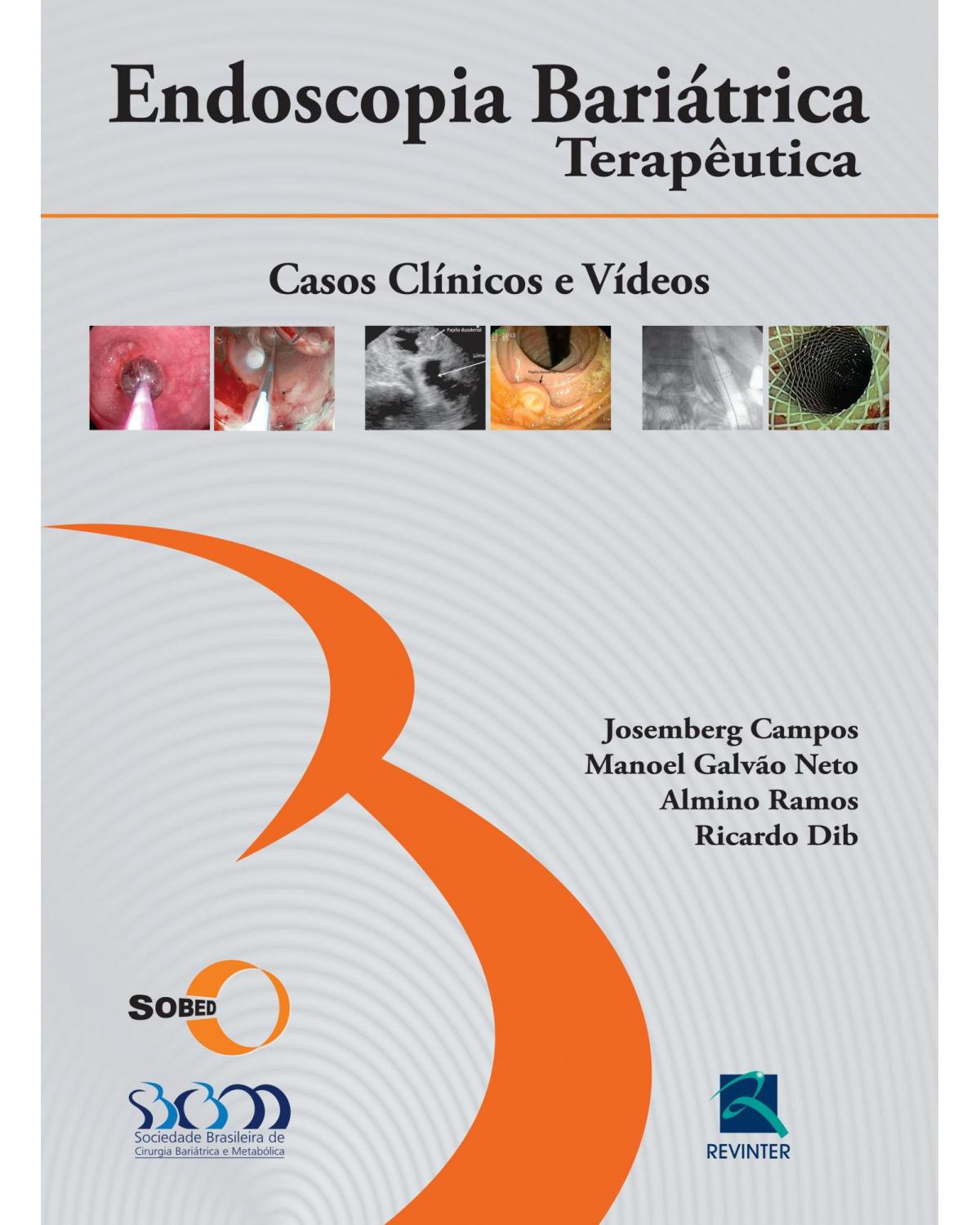Endoscopia bariátrica terapêutica - casos clínicos e vídeos - 1ª Edição | 2014